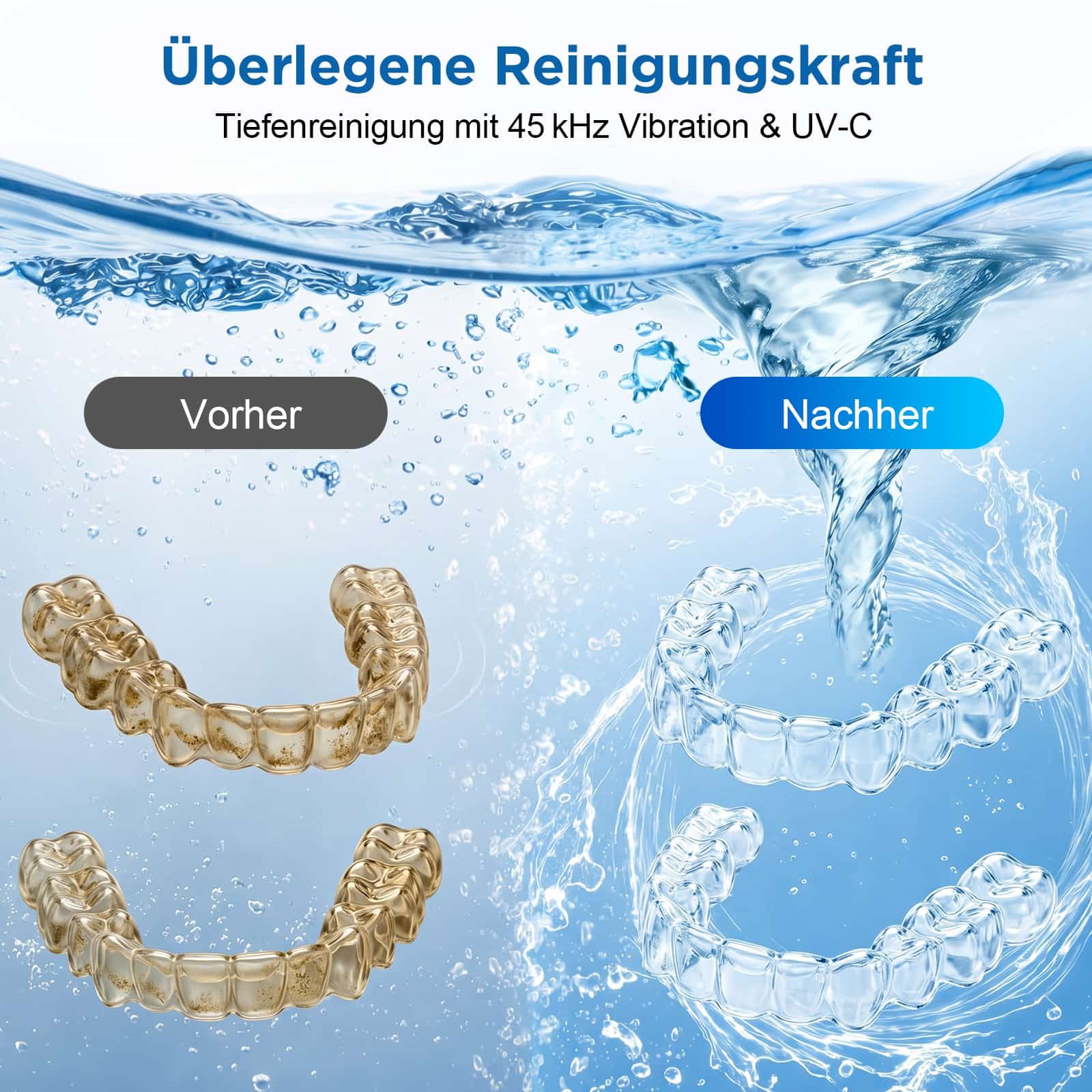 ANYSUN Ultraschallreiniger UV Ultraschallreinigungsgerät Ultraschall-Zahnreinigungsgerät, 24W Mit UV-Licht, zur Desinfektion mit 2 Modi mit Bakterienabtötung.