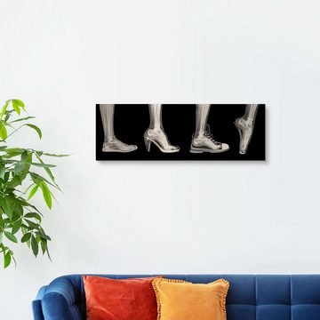 Posterlounge Holzbild PhotoStock-Israel, Verschiedene Schuhe (Röntgenbild), Arztpraxis Fotografie