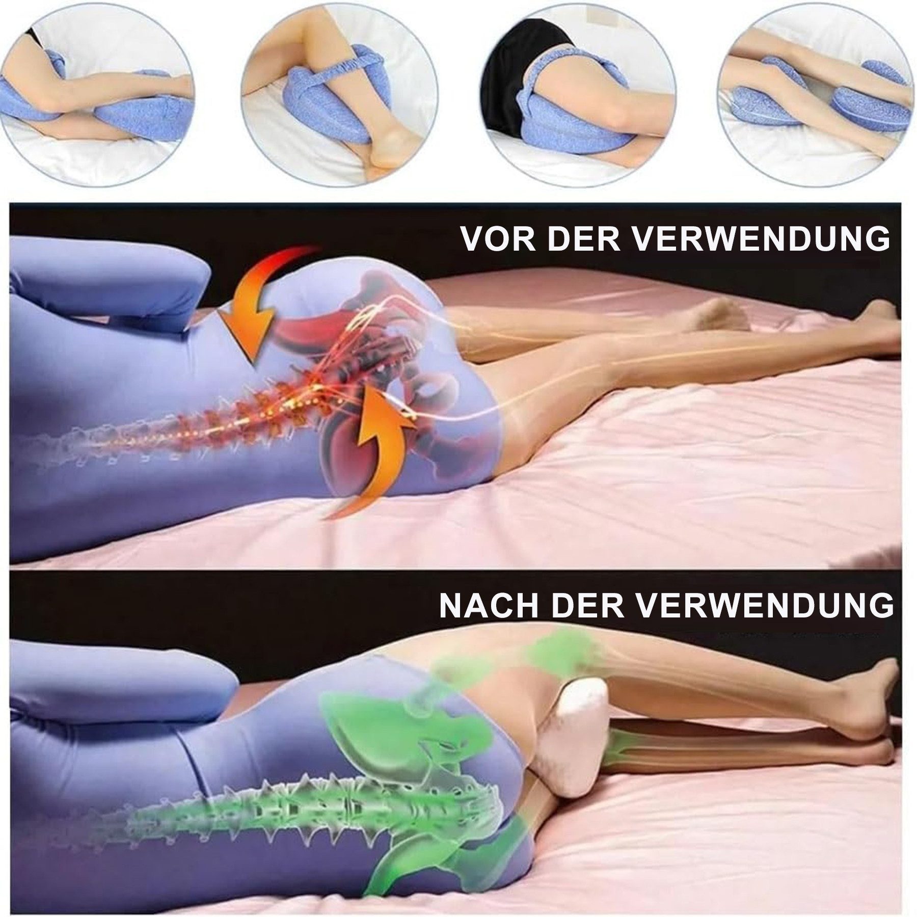 Keyura Balancekissen Kniekissen für Seitenschläfer,2 Stück Ergonomisches Lagerungskissen, Memory-Schaum für Rücken-/Hüft-/Gelenk- und Ischiasschmerzlinderung