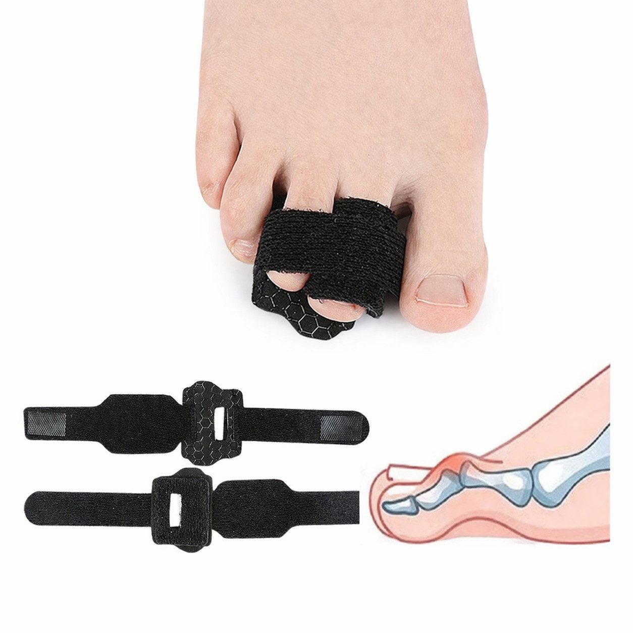 COOL-i ® Fußbandage Zehenschiene mit Aluminiumstütze, verstellbare Zehenbandage, rutschhemmend & atmungsaktiv