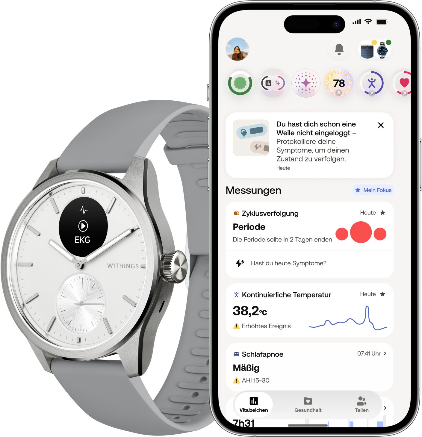 Withings ScanWatch 2 42mm, hybrid, Akku bis 35 Tage, 50 M Wasserdicht Smartwatch (HealthSense OS), Aktivitätstracking, Schlafüberwachung, Herzgesundheit, Temperatur uvm.