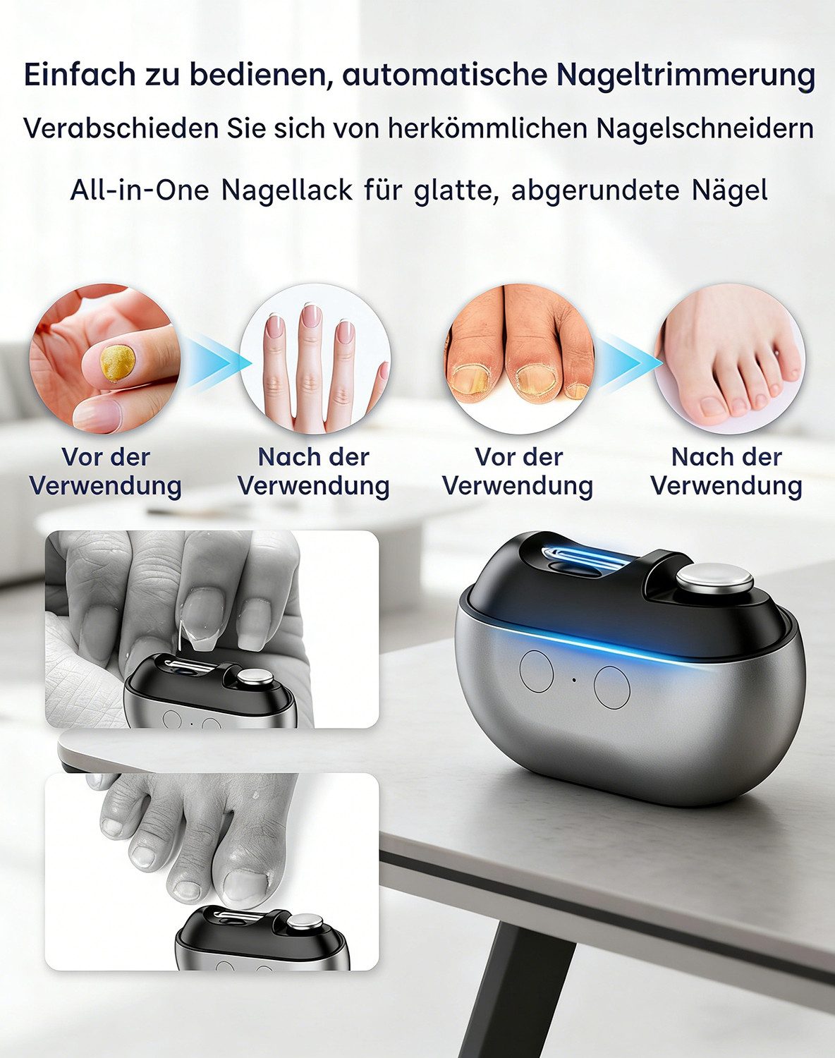 Toomoke Nagelknipser Elektrische Nagelknipser, 2 in 1 Polieren Automatisch, Mit Led-Licht, Stille Nagelknipser Elektrisch für Babys Erwachsene Senioren – Bild 4 von 5