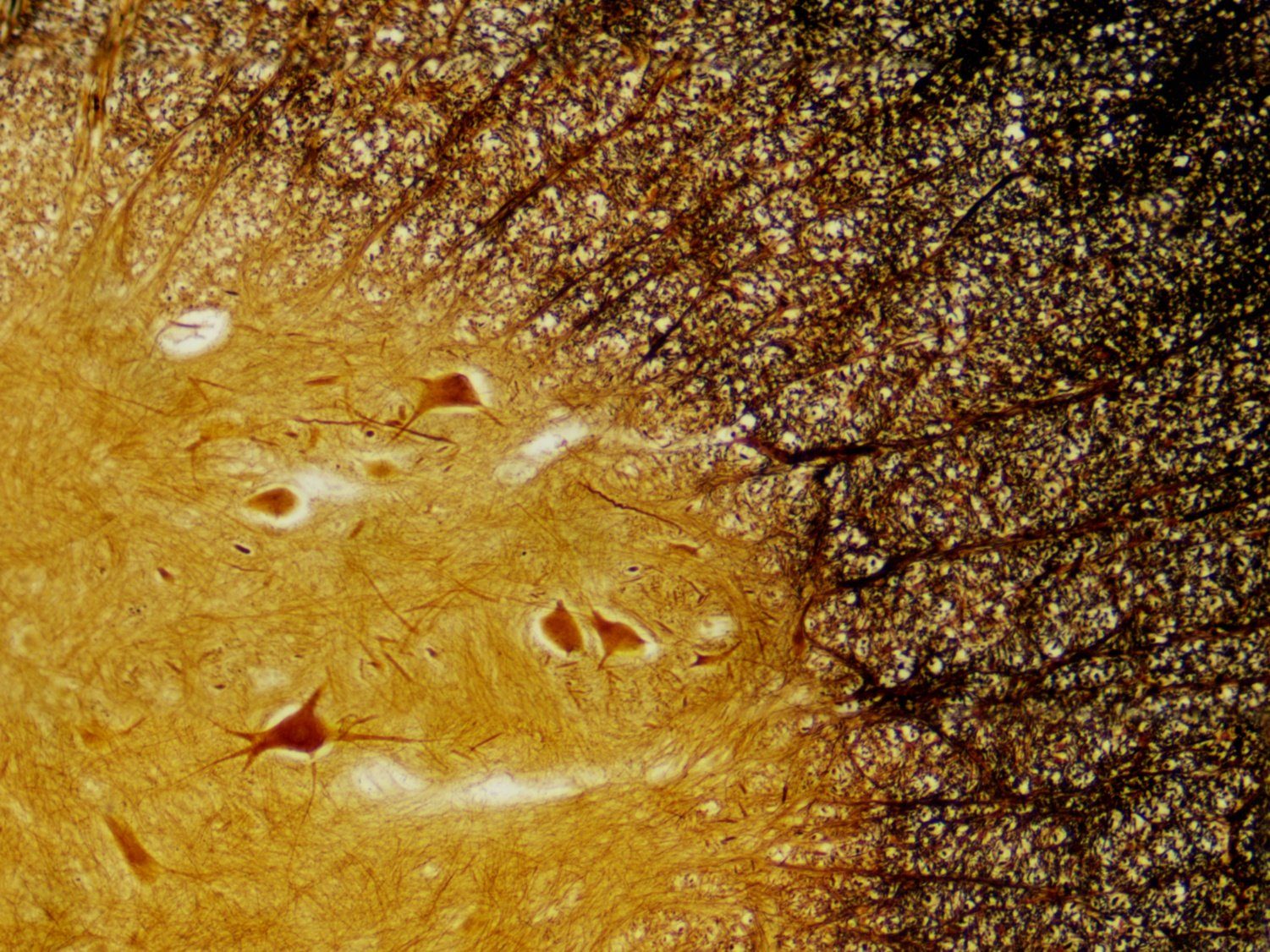 BRESSER BRESSER Dauerpräparate: Histologie Auf- und Durchlichtmikroskop