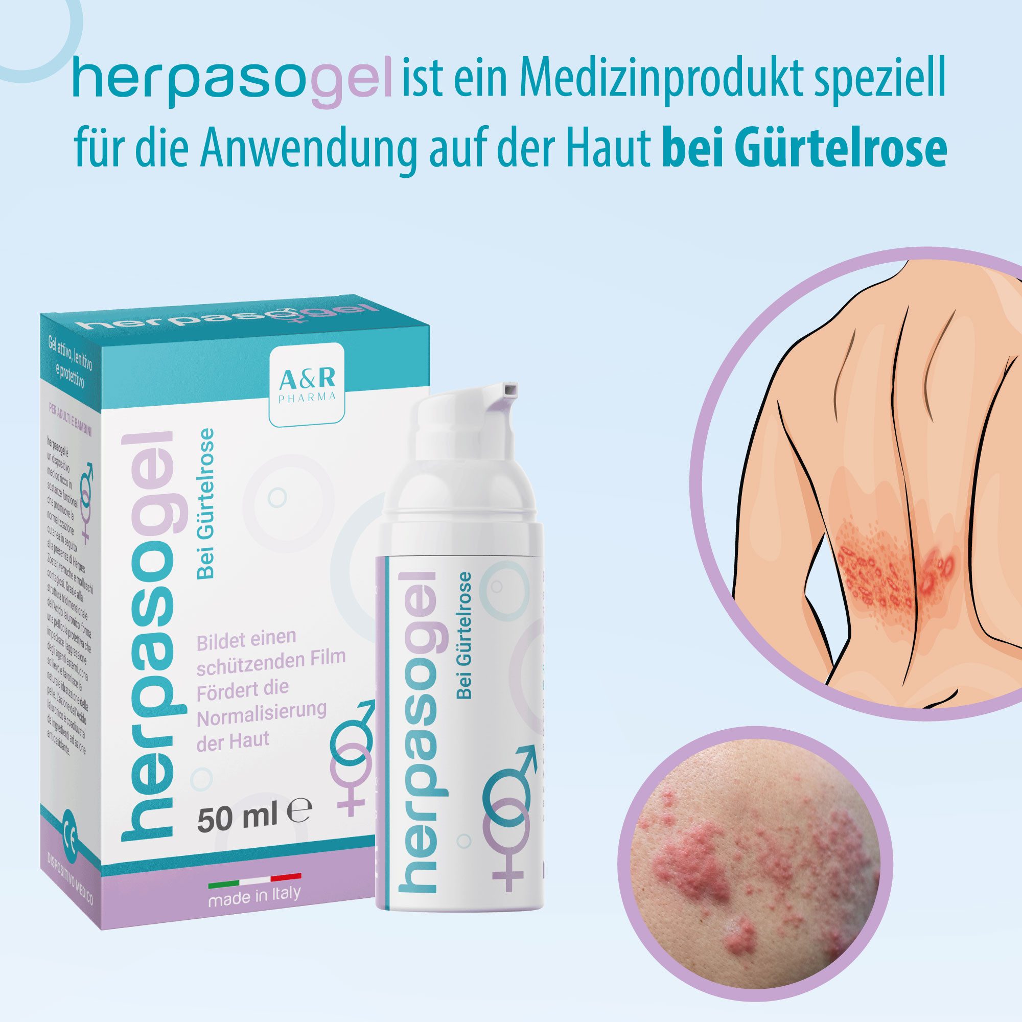 Evolsin Hautcreme Herpasogel bei Gürtelrose, Fördert die Normalisierung der Haut