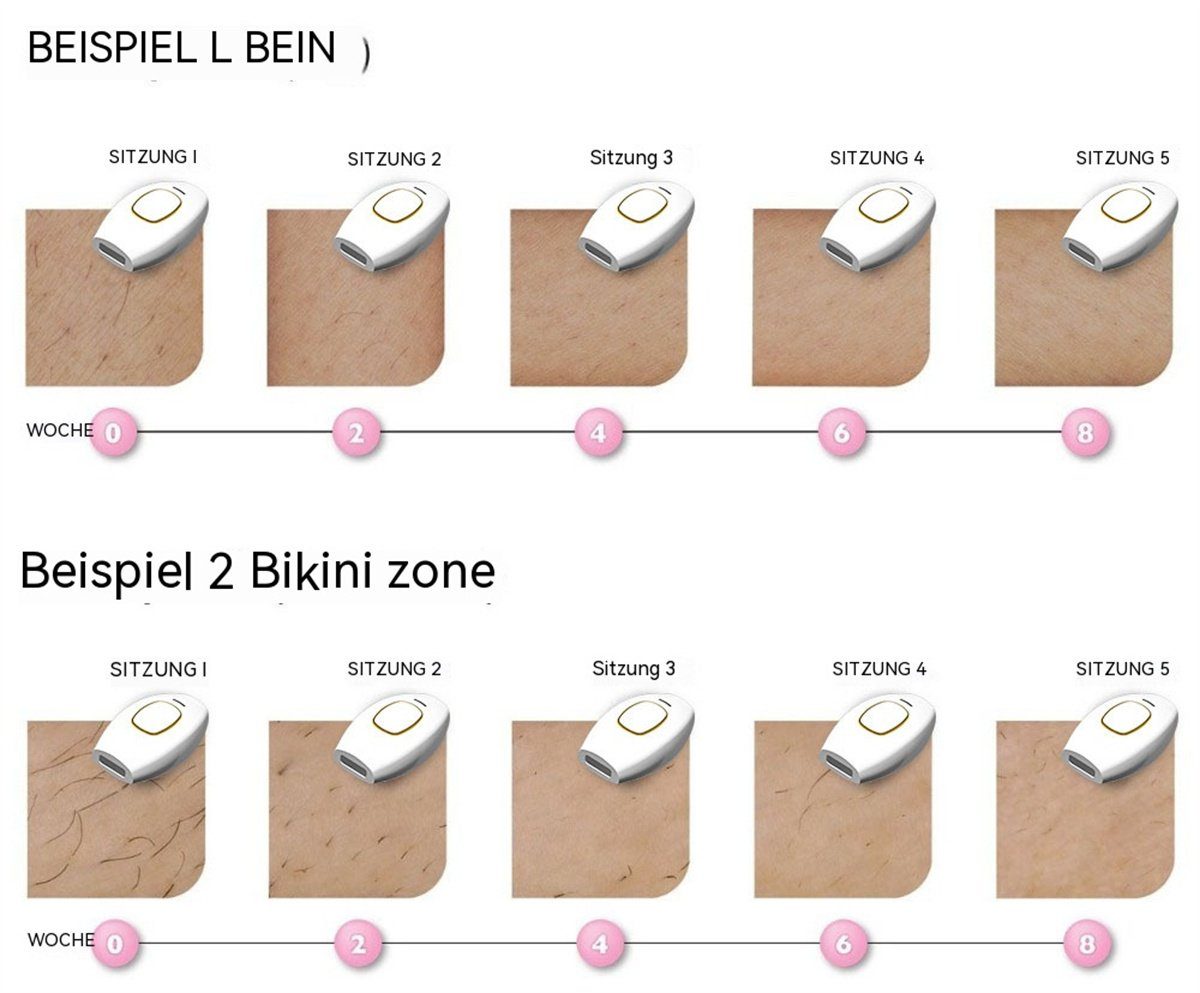 carefully selected IPL-Haarentferner Haarentfernungsgerät Laser-Haarentfernung, Schmerzlose Unisex Weiß