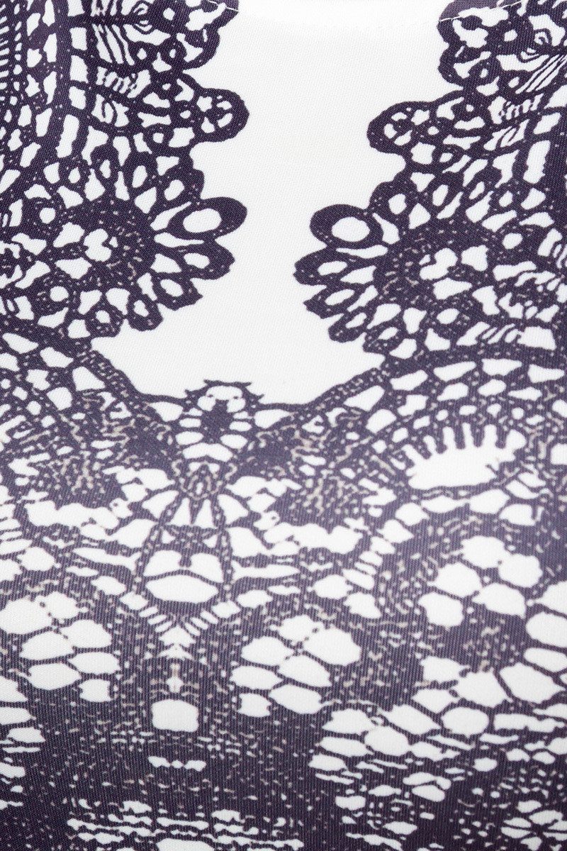 Atixo Minikleid Schwarz weißes Damen Baumwoll Sommerkleid mit Spitzenmuster knielang E