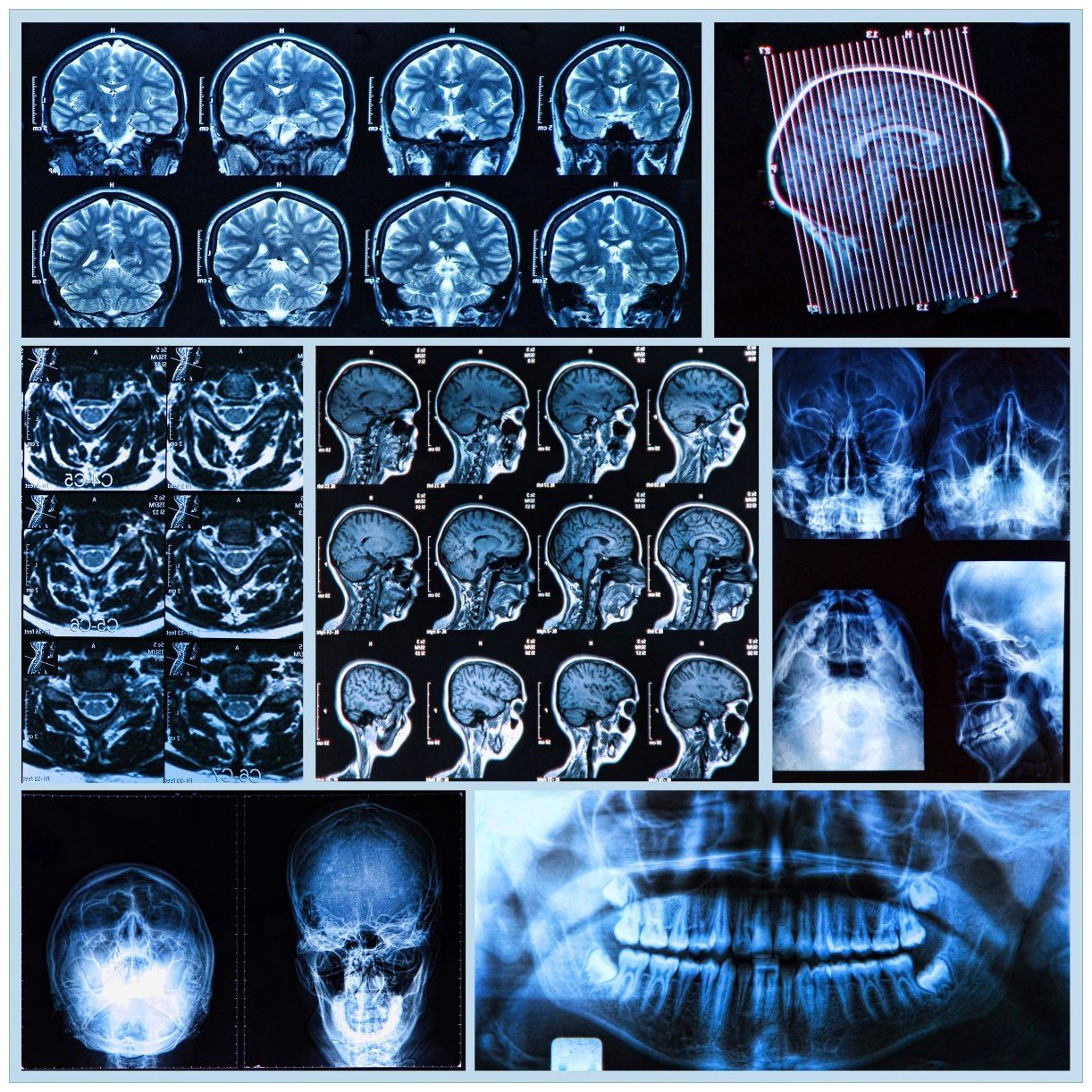 Wallario Tischplatte Röntgen-Bilder eines menschlichen Kopfes von allen Seiten (1 St), für Ikea Lack Tisch geeignet