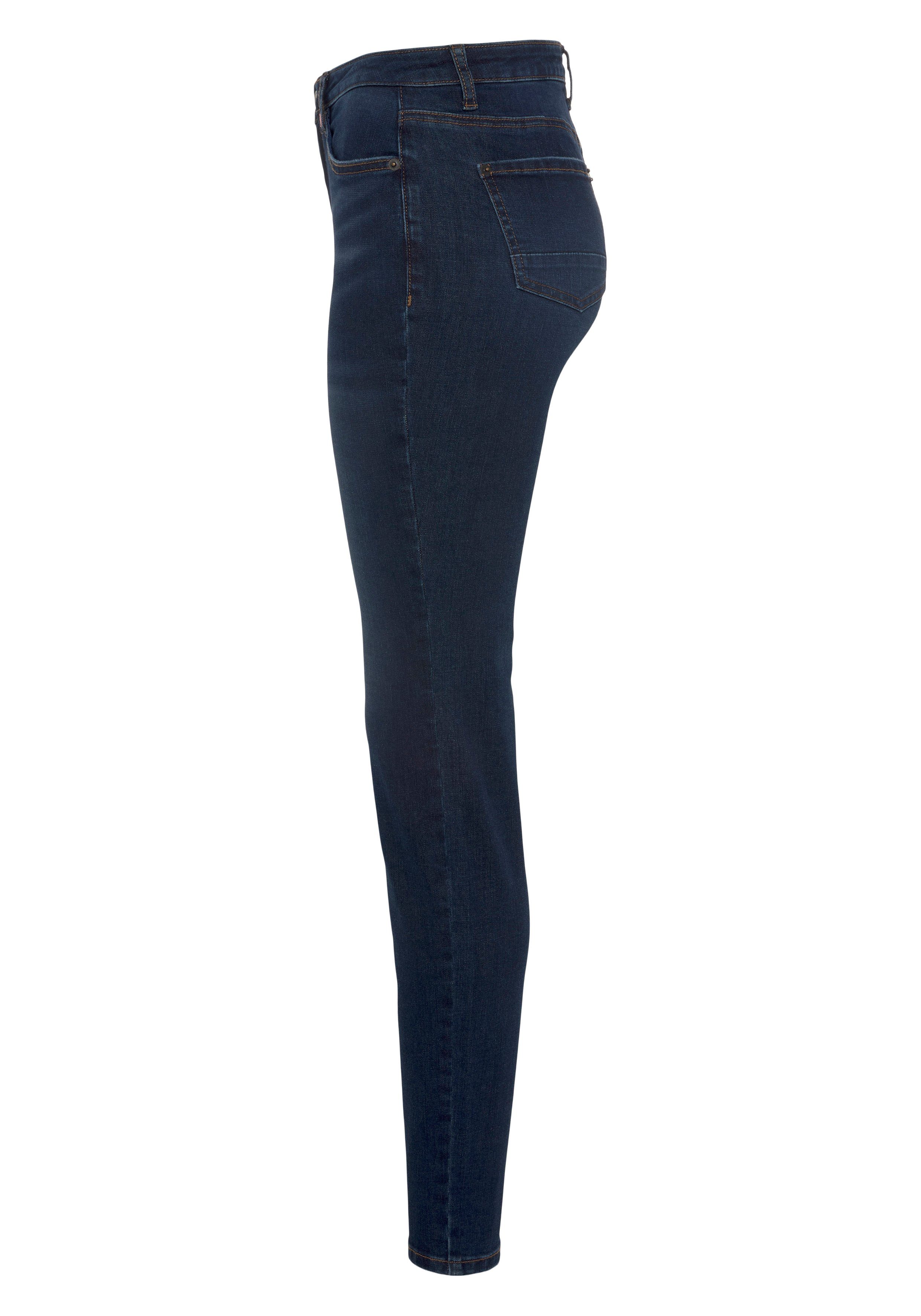 Kickin blue High-waist-Jeans NEUE used & NolaAK Alife KOLLEKTION used dark Slim-Fit