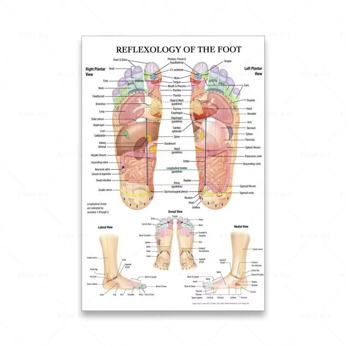 TPFLiving Kunstdruck (OHNE RAHMEN) Poster - Leinwand - Wandbild, Akupunkturpunkte Diagramm Anatomie Fuß Reflexzonen Leinwand (Leinwandbild XXL), Farben: Braun, Rosa, Gelb, Blau, Schwarz, Rot - Größe: 30x40cm