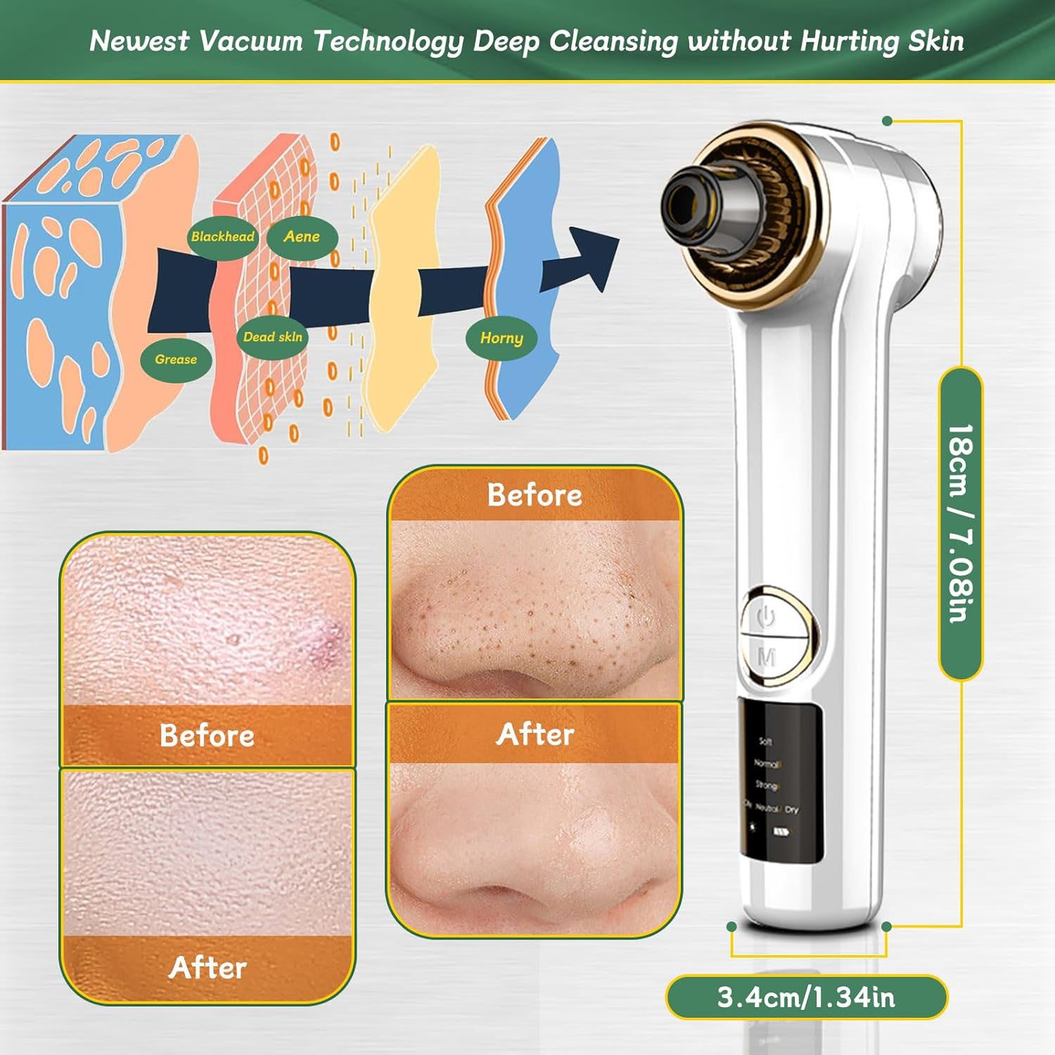 MOPUEA Porenreiniger Mitesser-Entferner, 2-in-1-Porenstaubsauger, Staubsauger, Elektrischer Mitesserentferner, Porenreiniger mit Heizmodus, 1-tlg., mit 3 Saugstufen und 5 Köpfe Blackhead Remover Pickelentferner