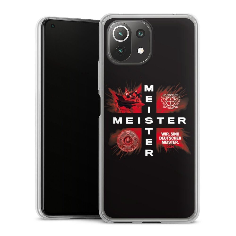DeinDesign Handyhülle Bayer 04 Leverkusen Meister Offizielles Lizenzprodukt, Xiaomi Mi 11 Lite 5G Slim Case Silikon Hülle Ultra Dünn Schutzhülle