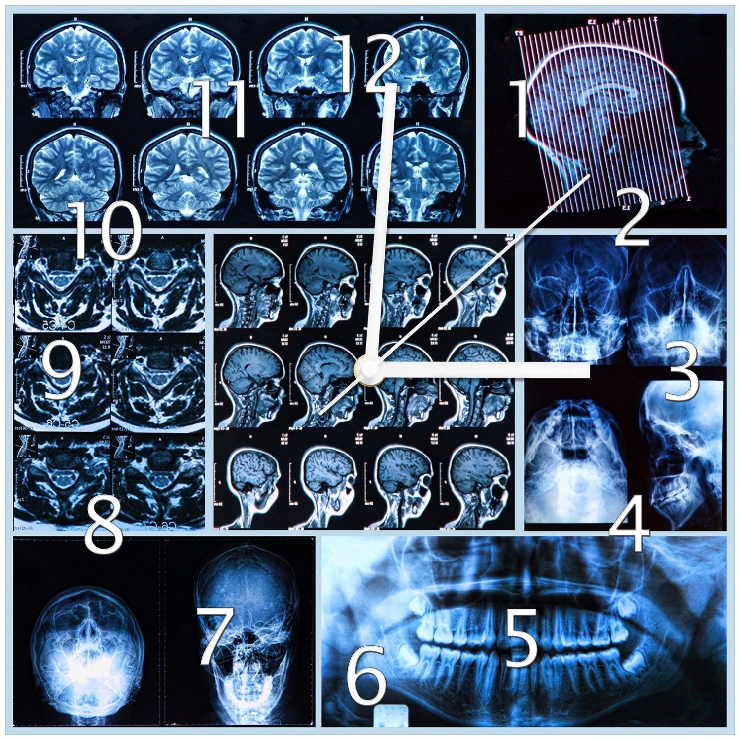 Wallario Wanduhr Röntgen-Bilder eines menschlichen Kopfes von allen Seiten (Glasuhr)