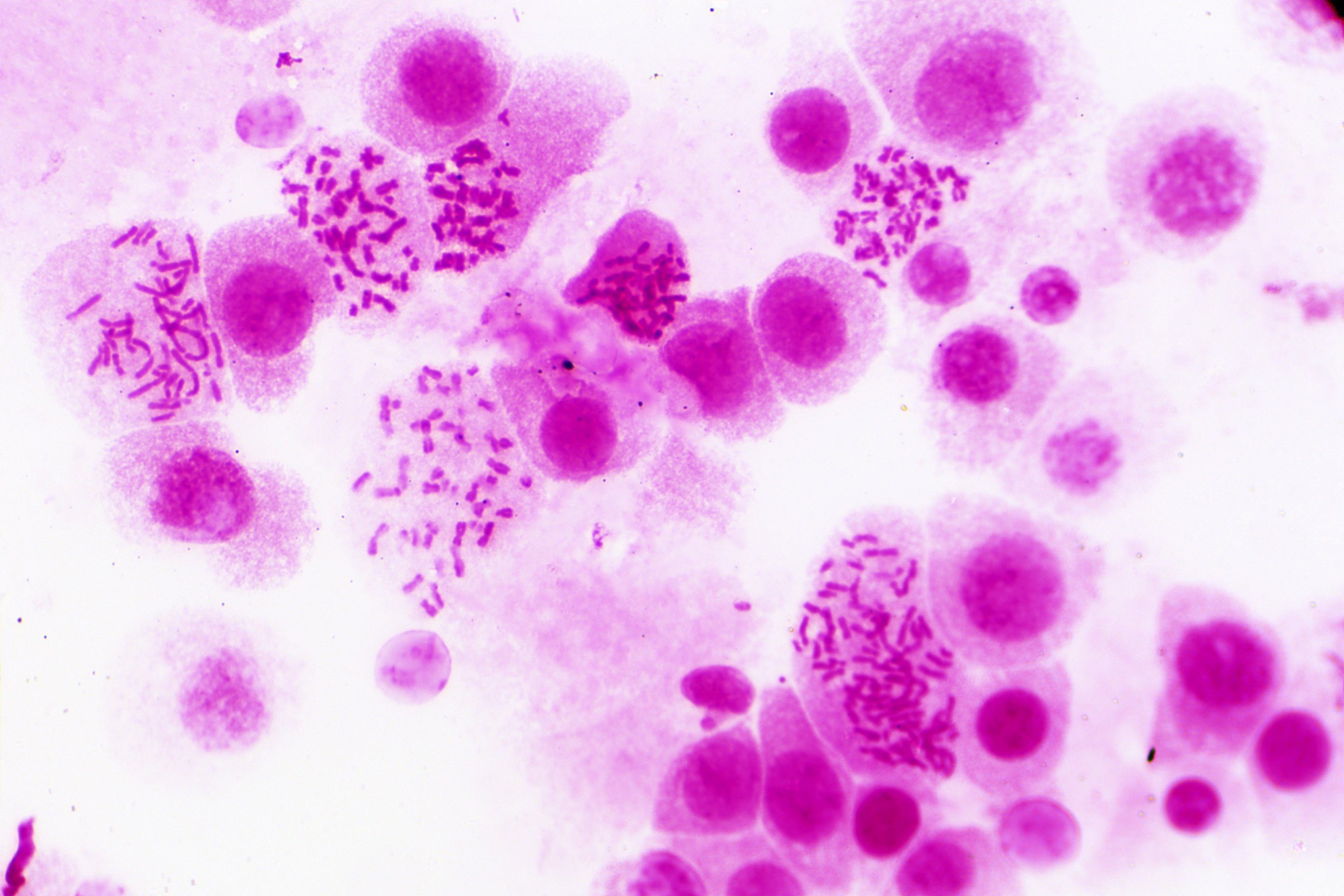 BRESSER BRESSER Dauerpräparate: Histologie Auf- und Durchlichtmikroskop