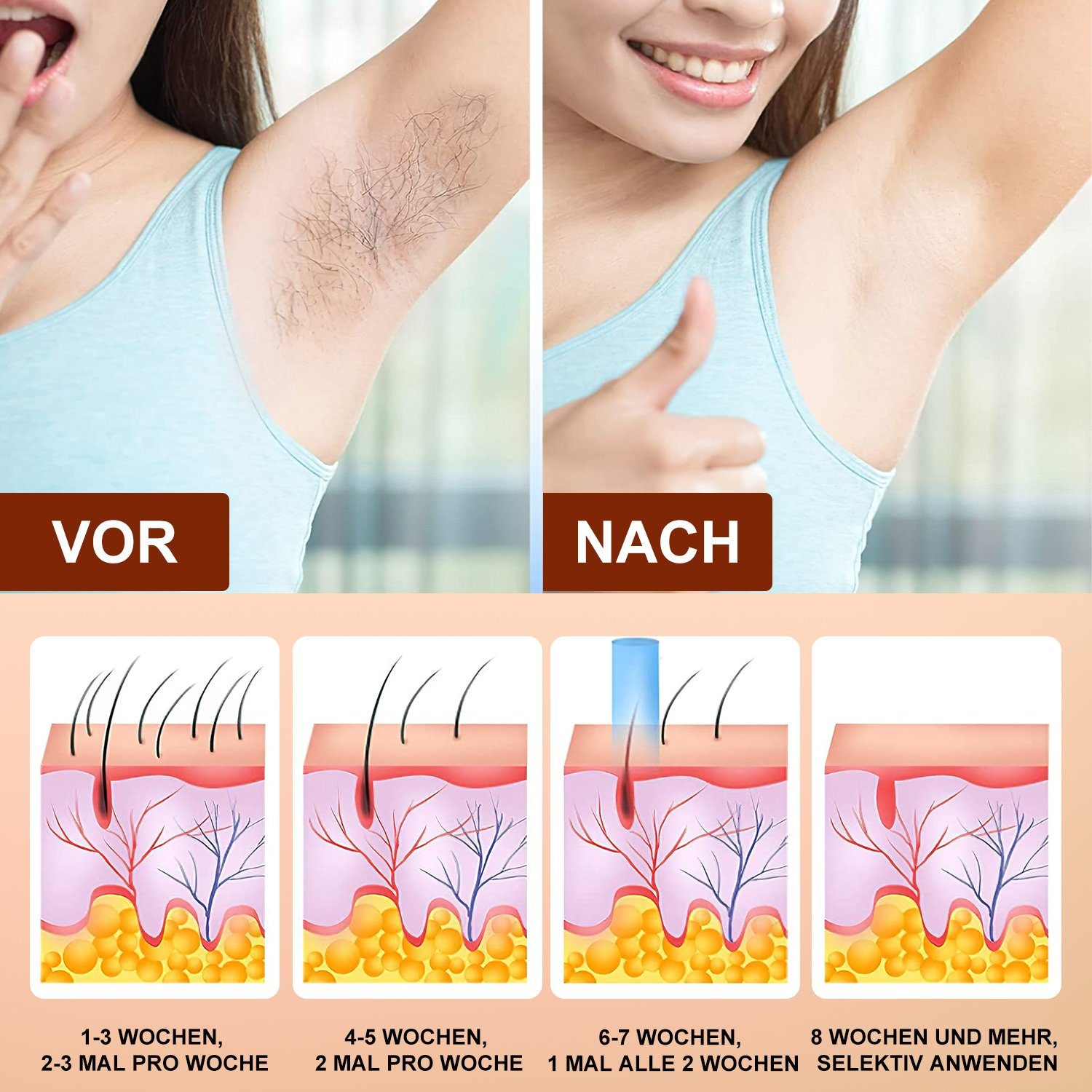 oyajia IPL-Haarentferner IPL-Haarentferner ganzen Hair Lichtimpulse, Haarentfernung (2 Tragbare Modi), am Dauerhafte 999,000 Skin schmerzfrei Körper, IPL Laser