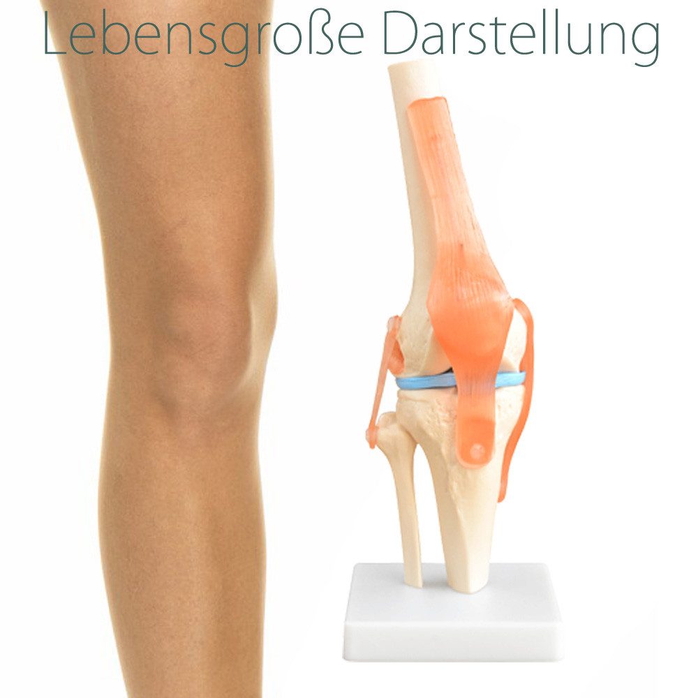MedMod Dekoobjekt Anatomie Skelett Modell Kniegelenk Lehrmodell Lebensgroß Knie – Bild 4 von 5