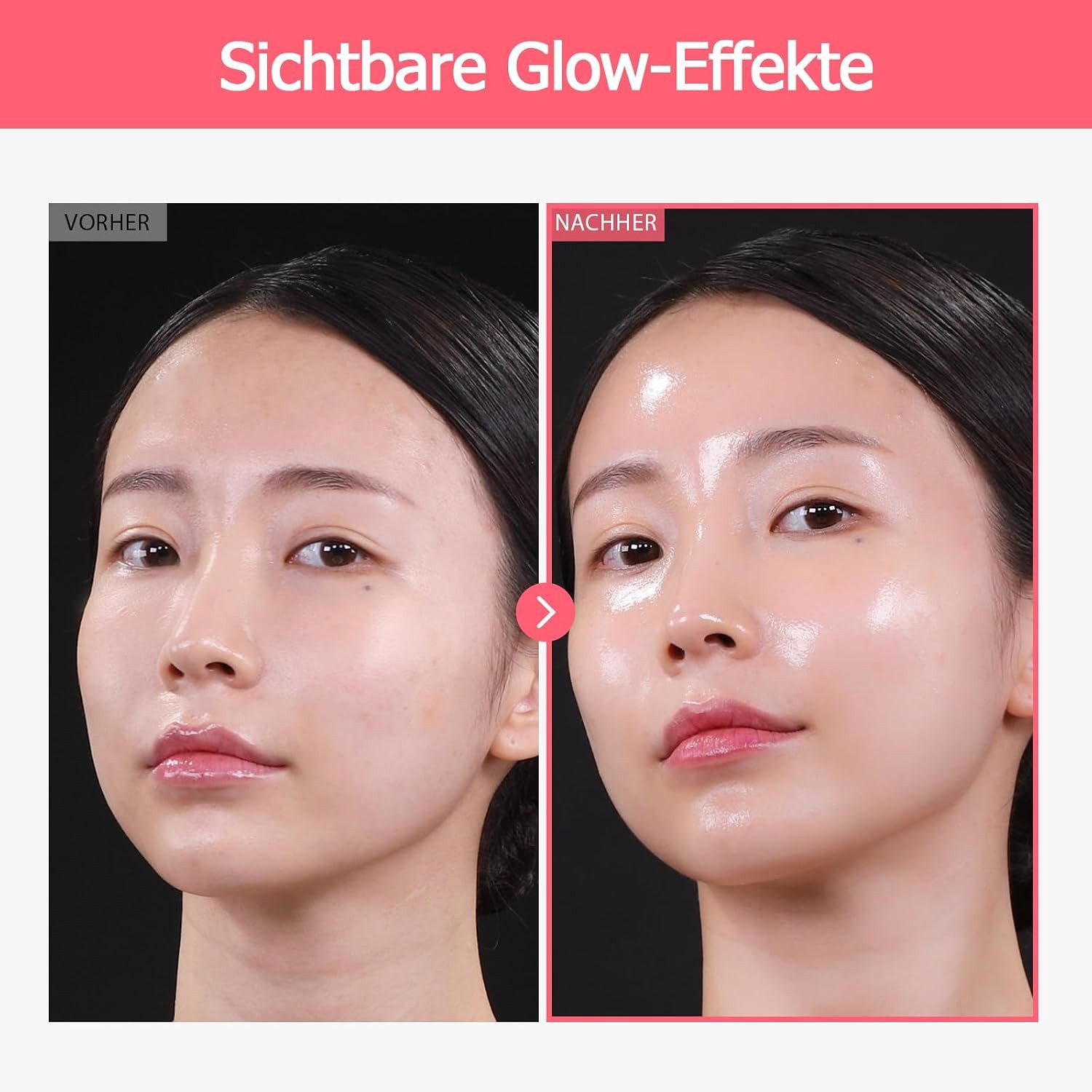 TOSOWOONG Hautcreme Strahlend ebenmäßige Haut mit Arbutin 7% + Tranexamsäure 4% für ungleichmäßigen Hautton, Koreanische Hautpflege