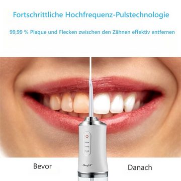 CkeyiN Zahnzwischenraum-Reiniger Professionelle Elektrische Munddusche, Aufsätze: 4 St., 360° drehbare Düse, Hochfrequenzimpuls, Tragbare Munddusche