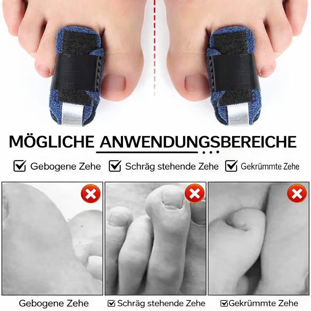 COOL-i ® Fingerbandage Zehenschiene verstellbar,Zehenbandage mit Aluminiumstütze, atmungsaktiv & rutschfest für Alltag & Schuhe