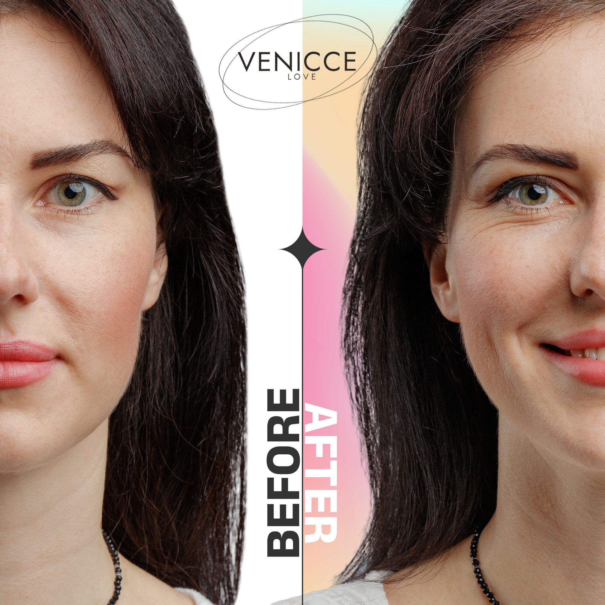 Venicce Love Augenlid-Tape Schlupflider Stripes, Augenlid Stripes, Augenlidstraffung ohne OP Anti-Aging, gegen Schlupflider