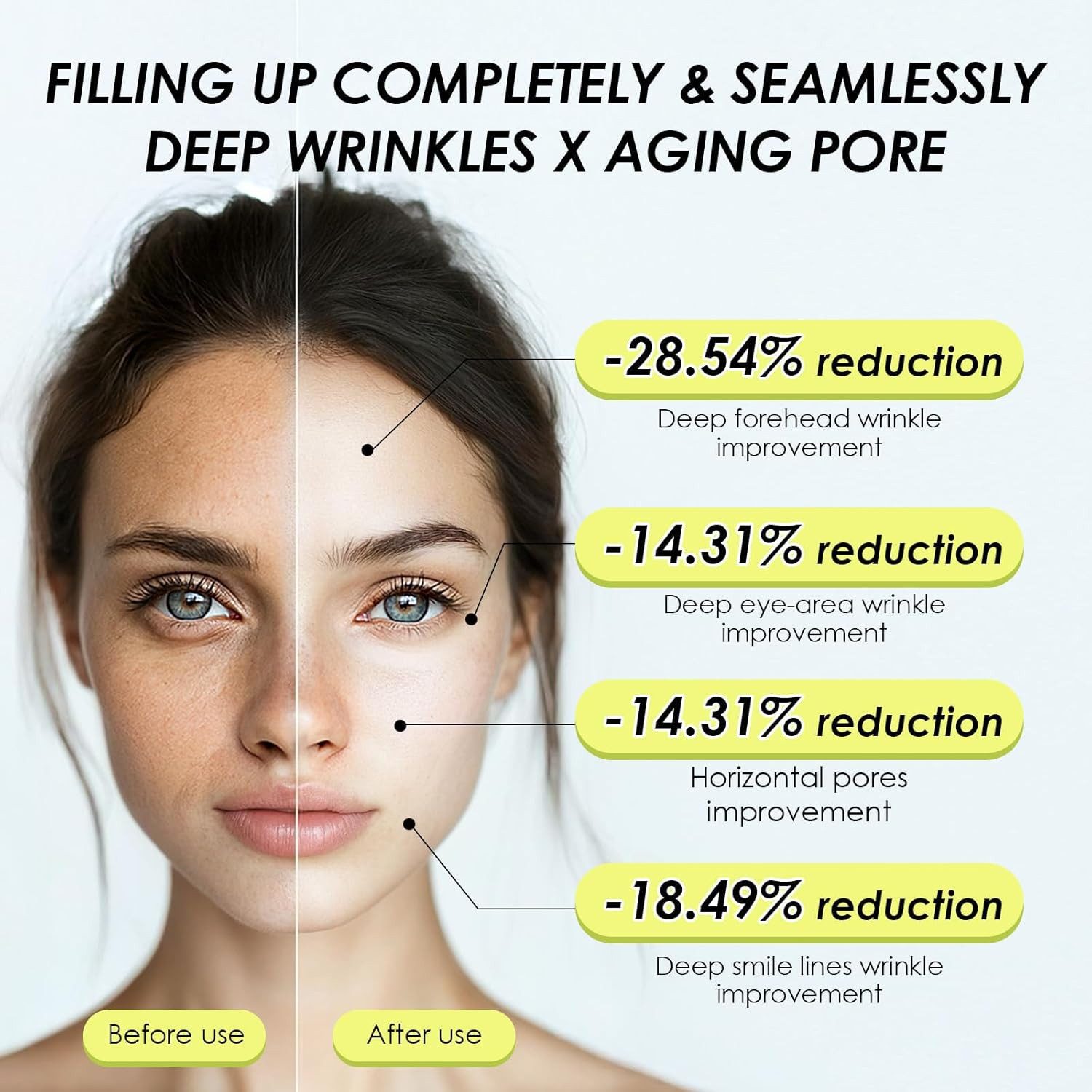 celimax Anti-Aging-Creme The Vita A Retinal Shot Straffungs-Booster mit Retinal 0,1%, Matryxyl 3%, Porenminimizer, Mehr als nur Anti‑Aging Ohne reizende Zusätze A‑Shot