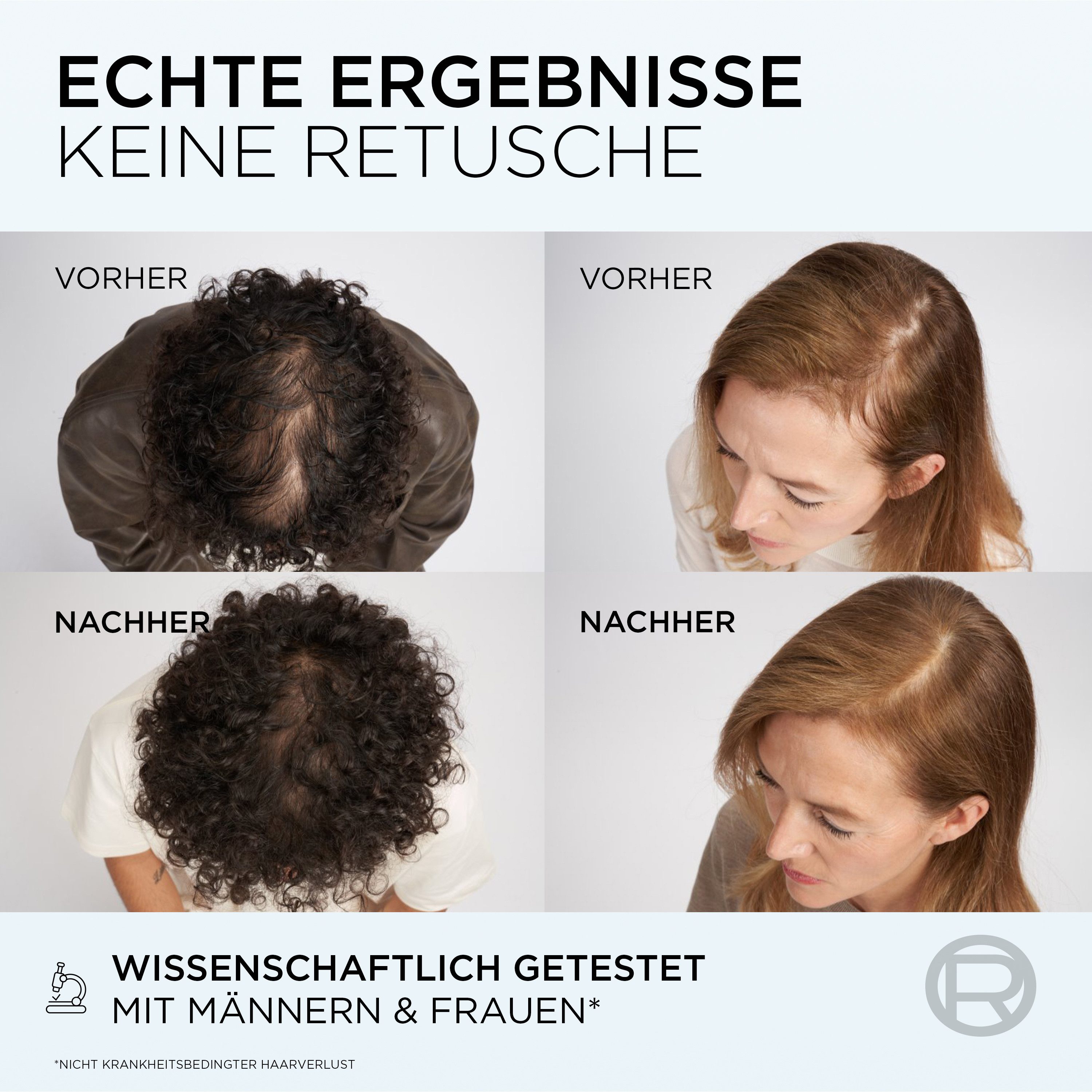 L'ORÉAL PARIS Haarserum L'Oréal Paris Elvital Fiber Booster Serum, Kur reduziert Haarverlust, verankert das Haar an der Wurzel.