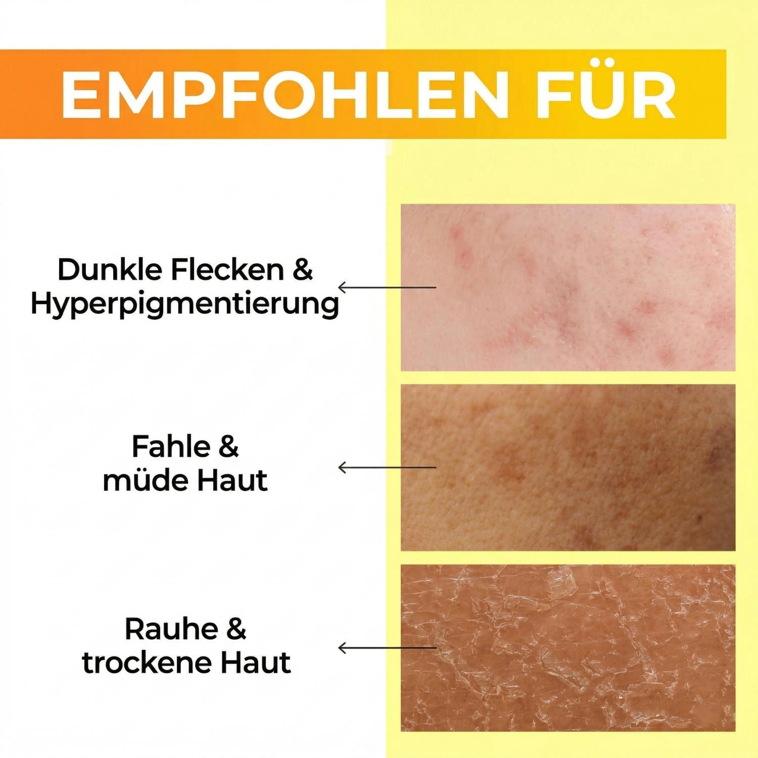 numbuzin Toner No.5 Vitamin Boosting Essential Toner 200 ml – Gesichtswasser mit Vitamin C, Niacinamid & Glutathion – aufhellender Essence Toner bei, Hyperpigmentierung & dunklen Flecken – revitalisierendes Toner