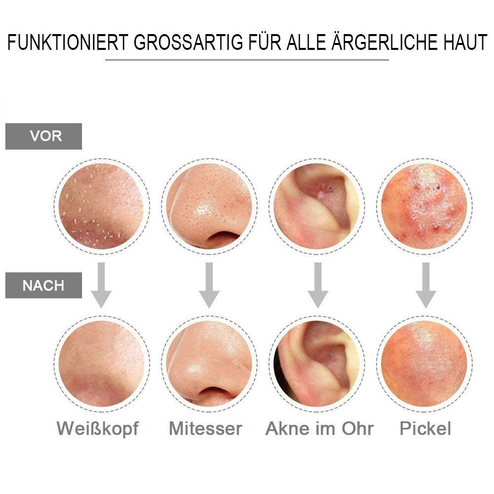 8-teiliges KSYLH 8-teiligesSet,Rost- korrosionsbeständig Akne-Nadel Set,Mitesser-Entfernungs-Nadel, Edelstahl-Akne-Nadel Pickelnadel und