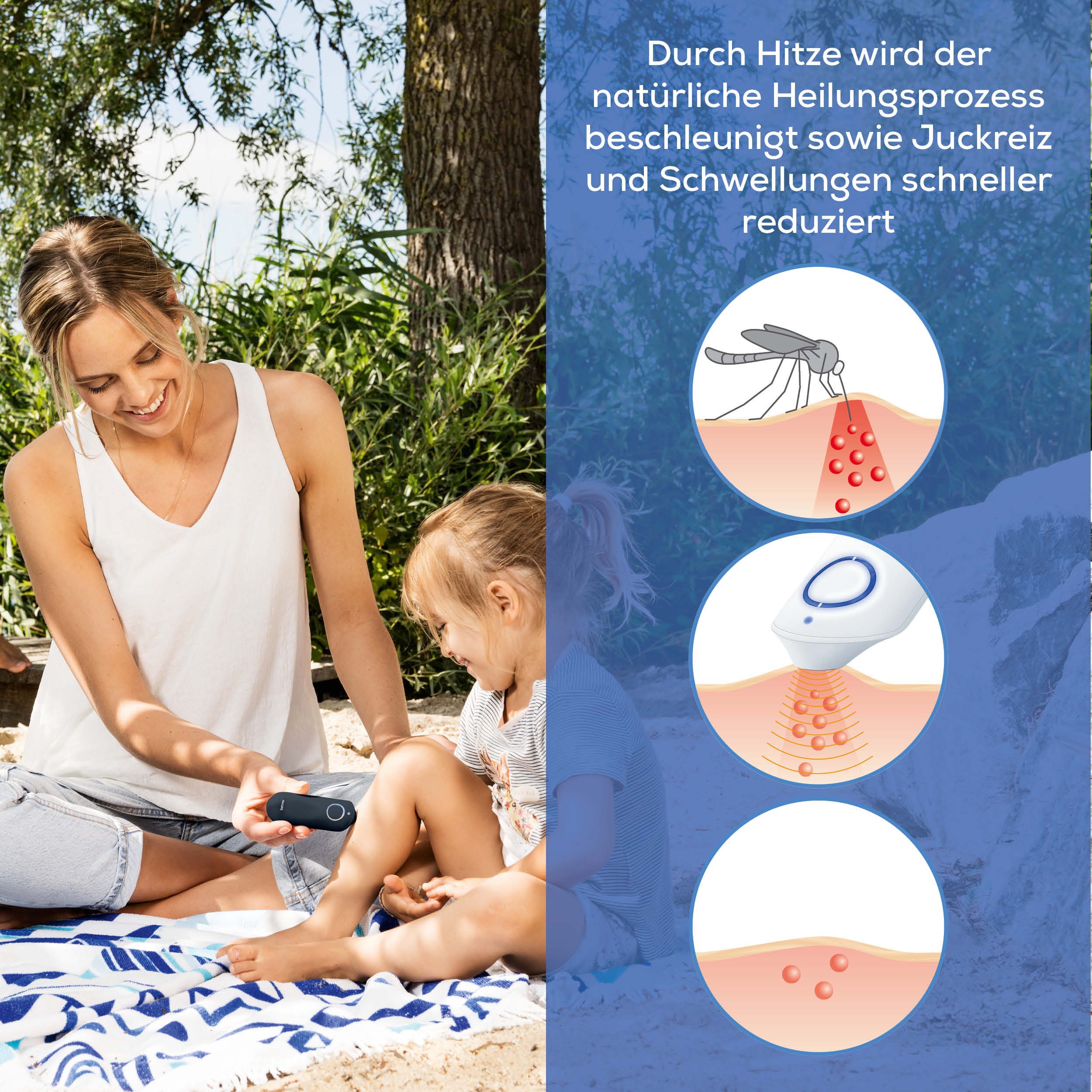 BEURER Insektenstichheiler BR 65+ Insektenstichheiler, Behandlung von Insektenstichen- und bissen, Kann Juckreiz lindern, ohne chemische Stoffe, klein und handlich