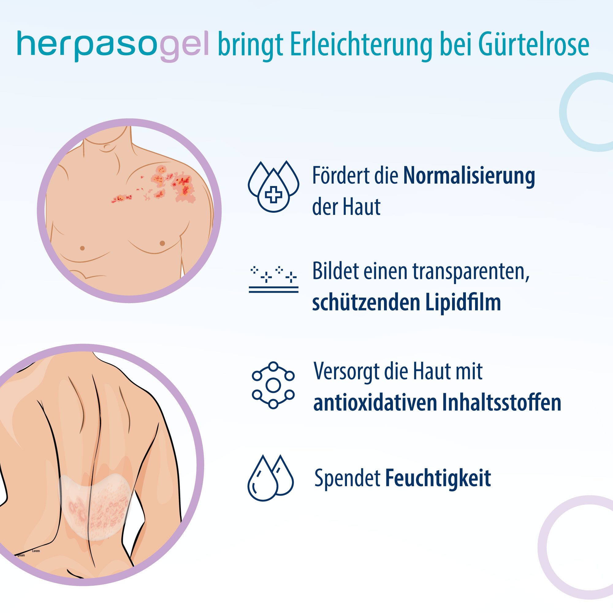 Evolsin Hautcreme Herpasogel bei Gürtelrose, Fördert die Normalisierung der Haut