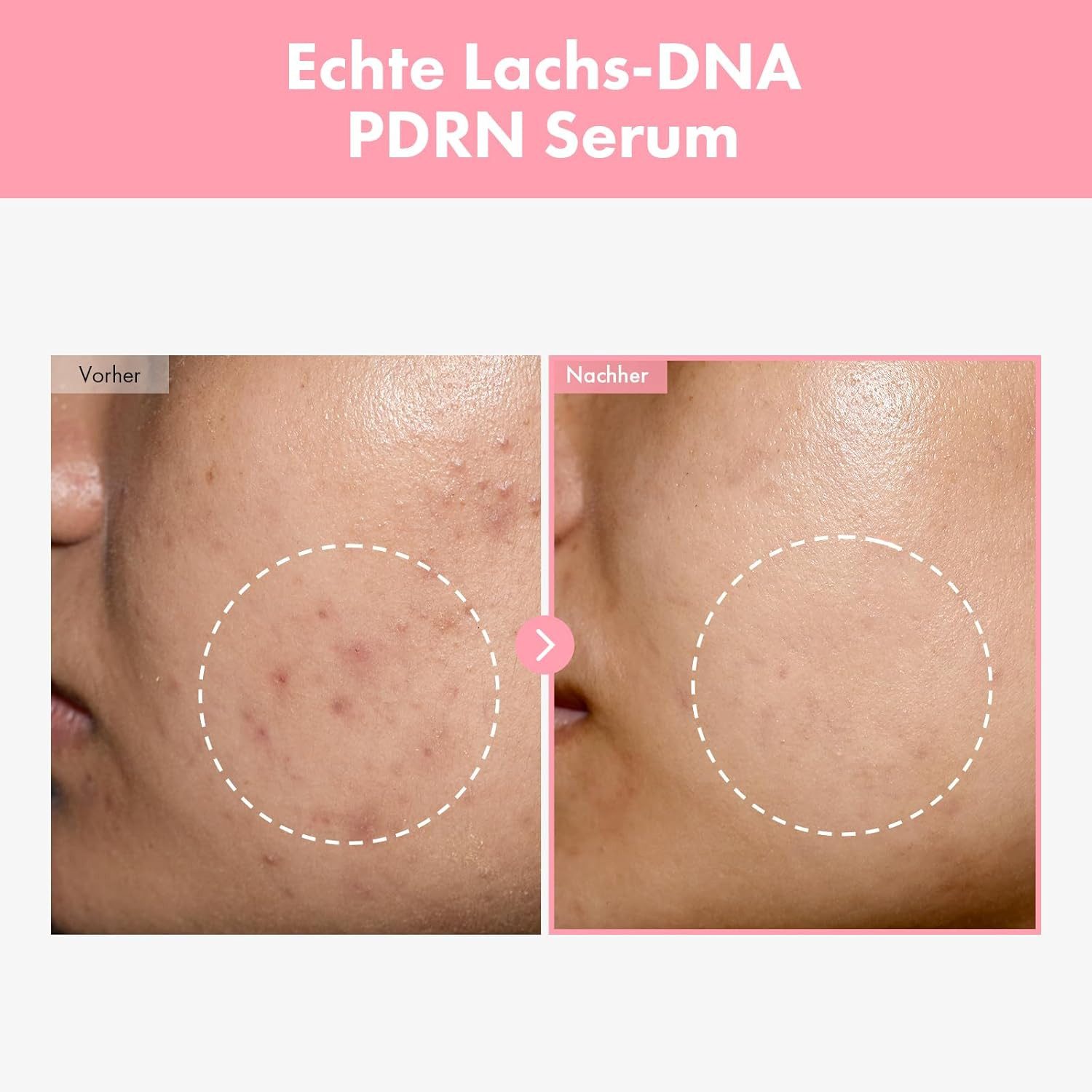 TOSOWOONG Gesichtsserum Pink Peptide 12 PDRN – 33 ml Sorgt für ein ebenmäßiges Hautbild und spendet intensive Feuchtigkeit, Korean Skincare mit PDRN & Peptiden