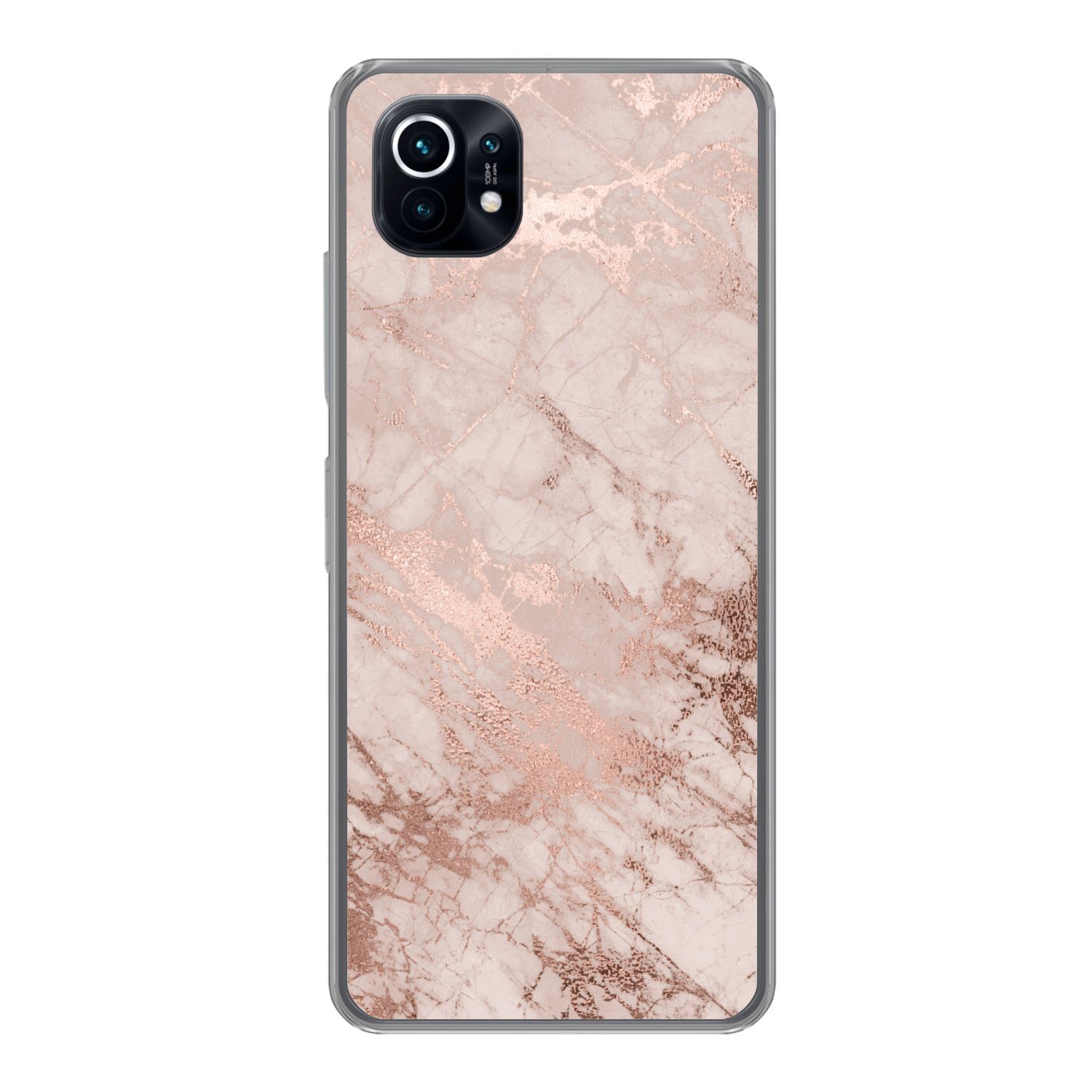 MuchoWow Handyhülle für Xiaomi Mi 11 Marmor - Rosa - Luxus - Marmoroptik - Glitzer - Desig, Phone Case, Silikon, Schutzhülle Dünn