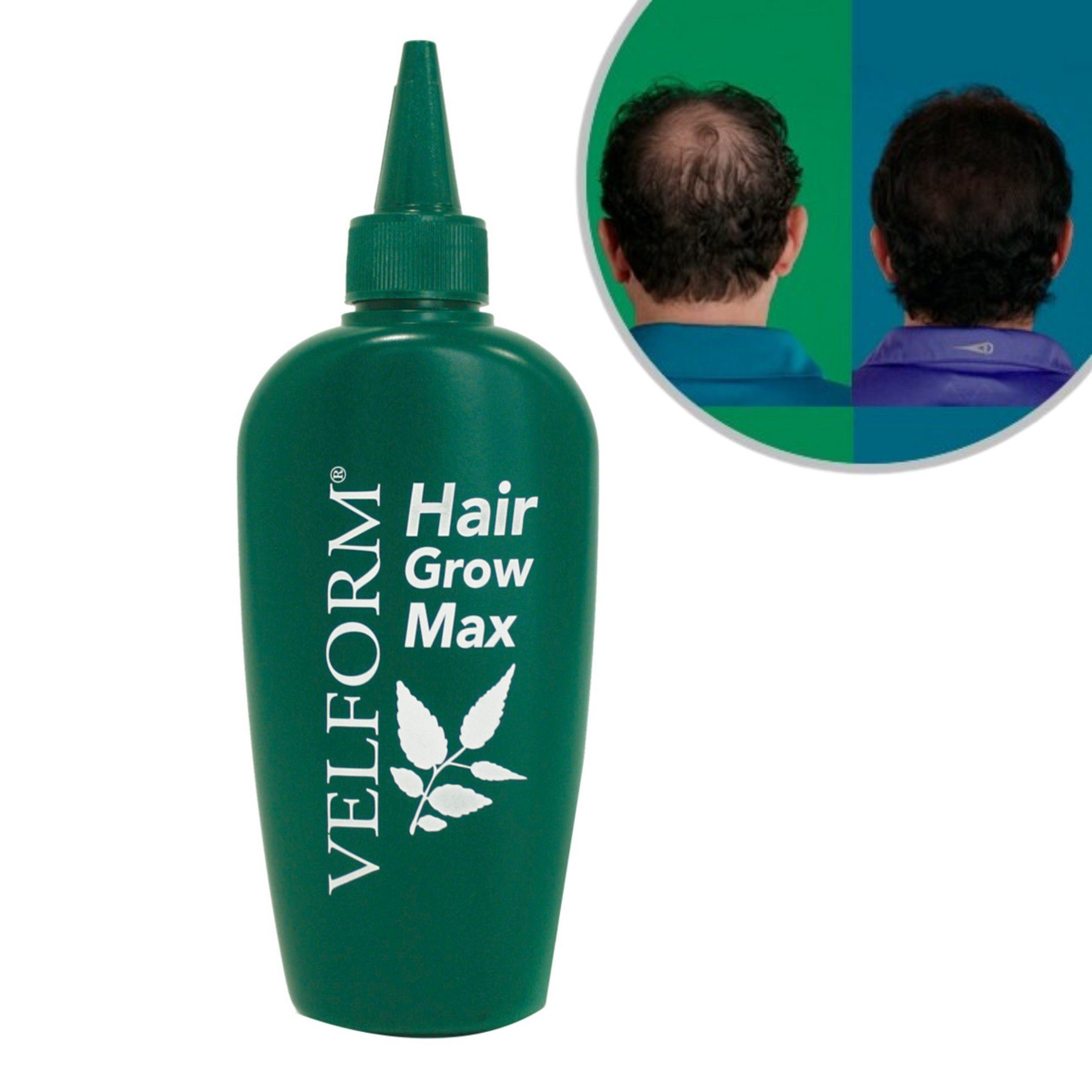 Velform® Haarkur Hair Grow Max Тоник для волос, Spar-Set, 1-tlg., 1er oder 3er Pack, Haarwuchsmittel aus 22 Pflanzen mit natürlichen Inhaltsstoffen