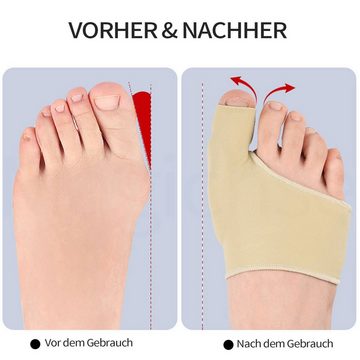 MAGICSHE Hallux-Bandage 1-Paar Korrektur von Hallux valgus, 2-tlg., Schmerzlindern, korrigieren Bandage