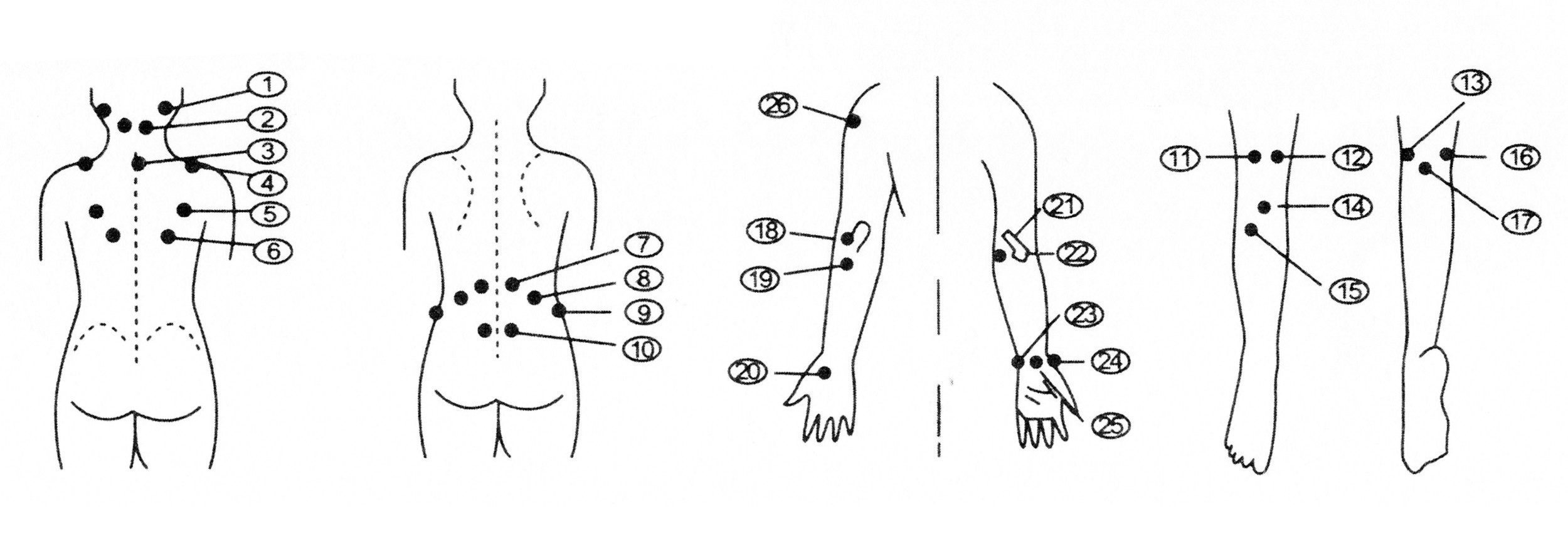 vom Pullach Hof Magnetpflaster 10x MAGNETPFLASTER Set 600-Gauss mit Anleitung Magnet Pflaster 64 (10 St), Körpermagnet Patches Magnetische Akupunktur