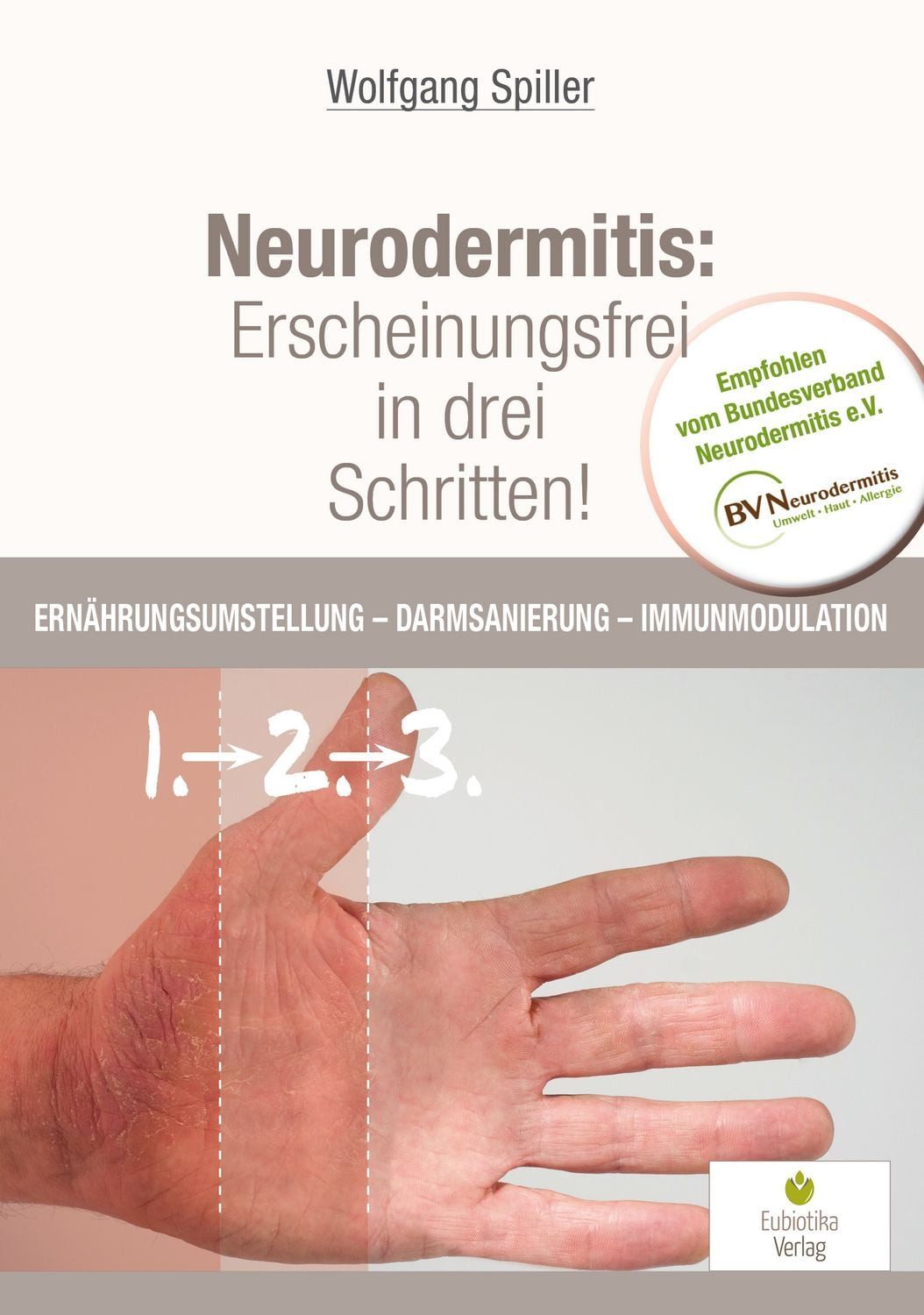 Neurodermitis: Erscheinungsfrei in drei Schritten! / Spiller Wolfgang