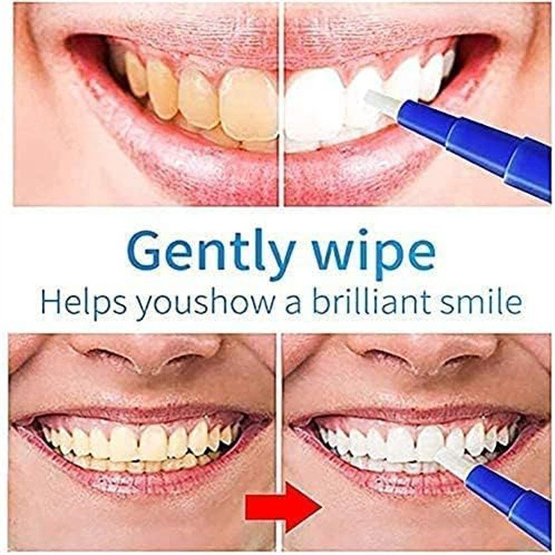 XDeer Zahnbleaching-Kit 2xZahnweiß Stift,Teeth Whitening Pen,20+Zahnaufhellung Anwendungen, Zahnbleaching,Schnelles Zähne Aufhellen,Sanftes Zähne Bleichen