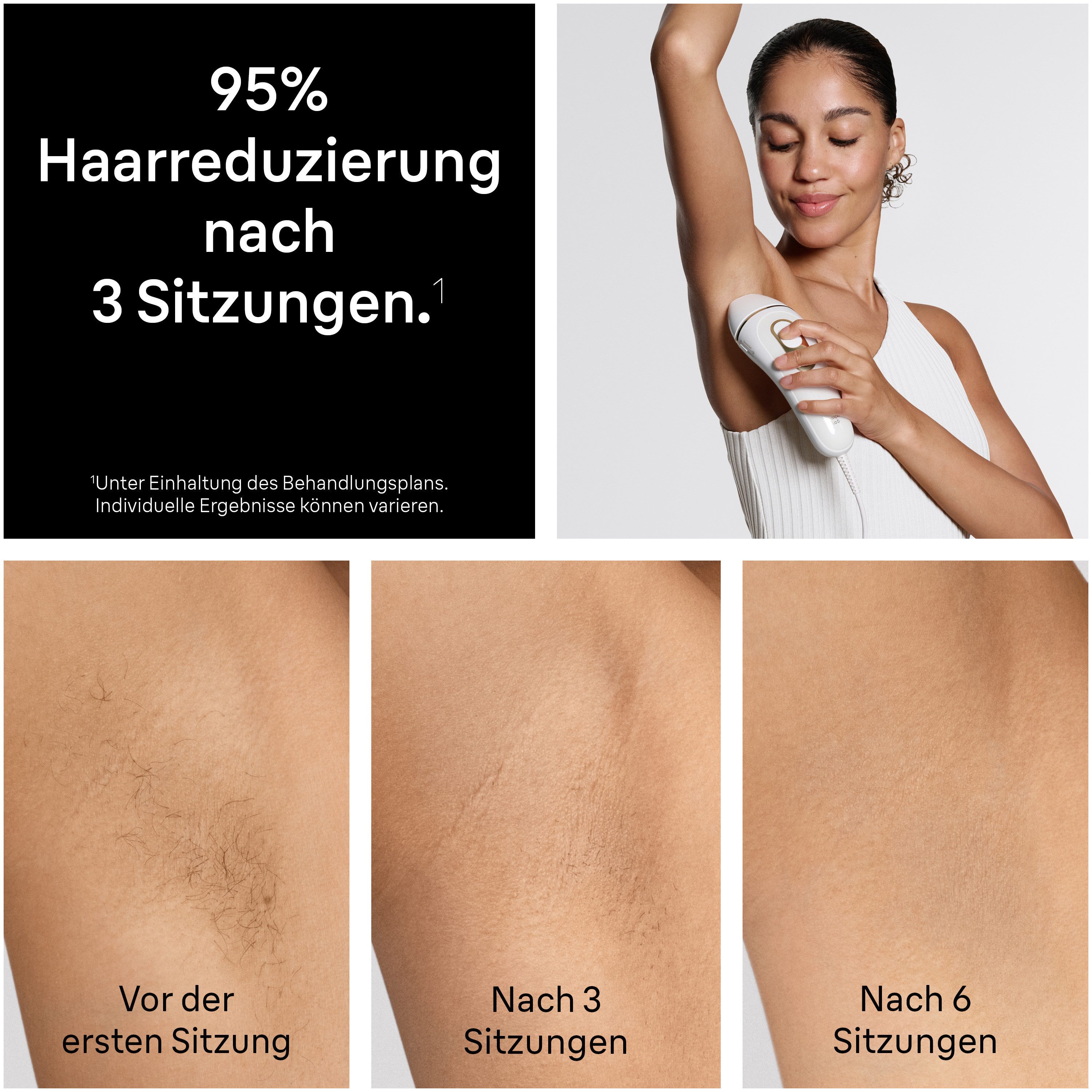 Braun IPL-Haarentferner Silk·expert Pro 5 PL5431 (Modell 2026) PL5262 (Modell 2025), pro Minute bis zu 125 Lichtimpulse, 3 Aufsätze, Aufbewahrungstasche, Venus Rasierer