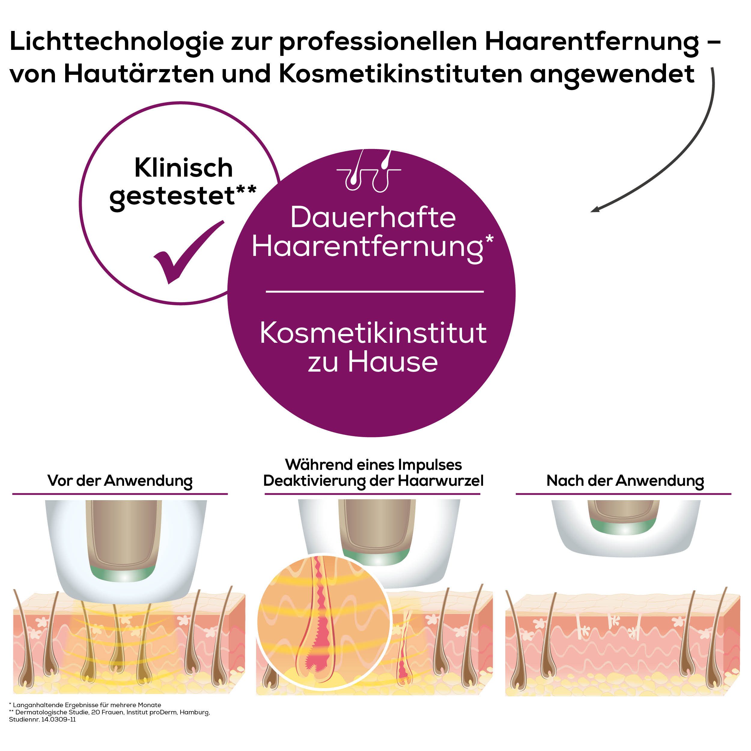 BEURER IPL-Haarentferner IPL 8500 für langanhaltende Haarentfernung durch Lichttechnologie, 300000 Lichtimpulse, Kraftvolles Akkugerät für eine flexible, kabellose Anwendung goldfarben|weiß
