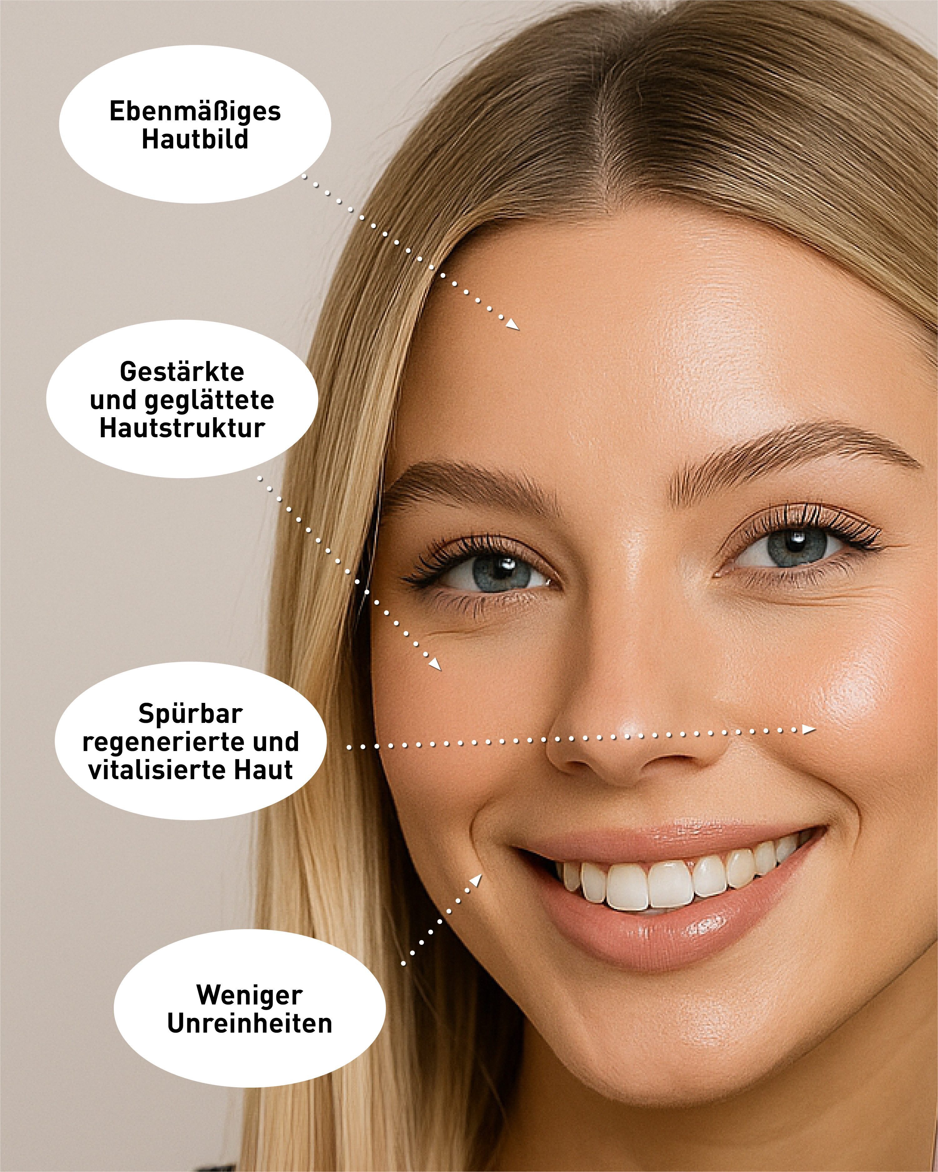N1 Healthcare Anti-Aging-Gerät My Coldplasma - Skin Beauty Booster, 1-tlg., Kaltes Plasma für Zuhause, für eine gesündere und strahlendere Haut.