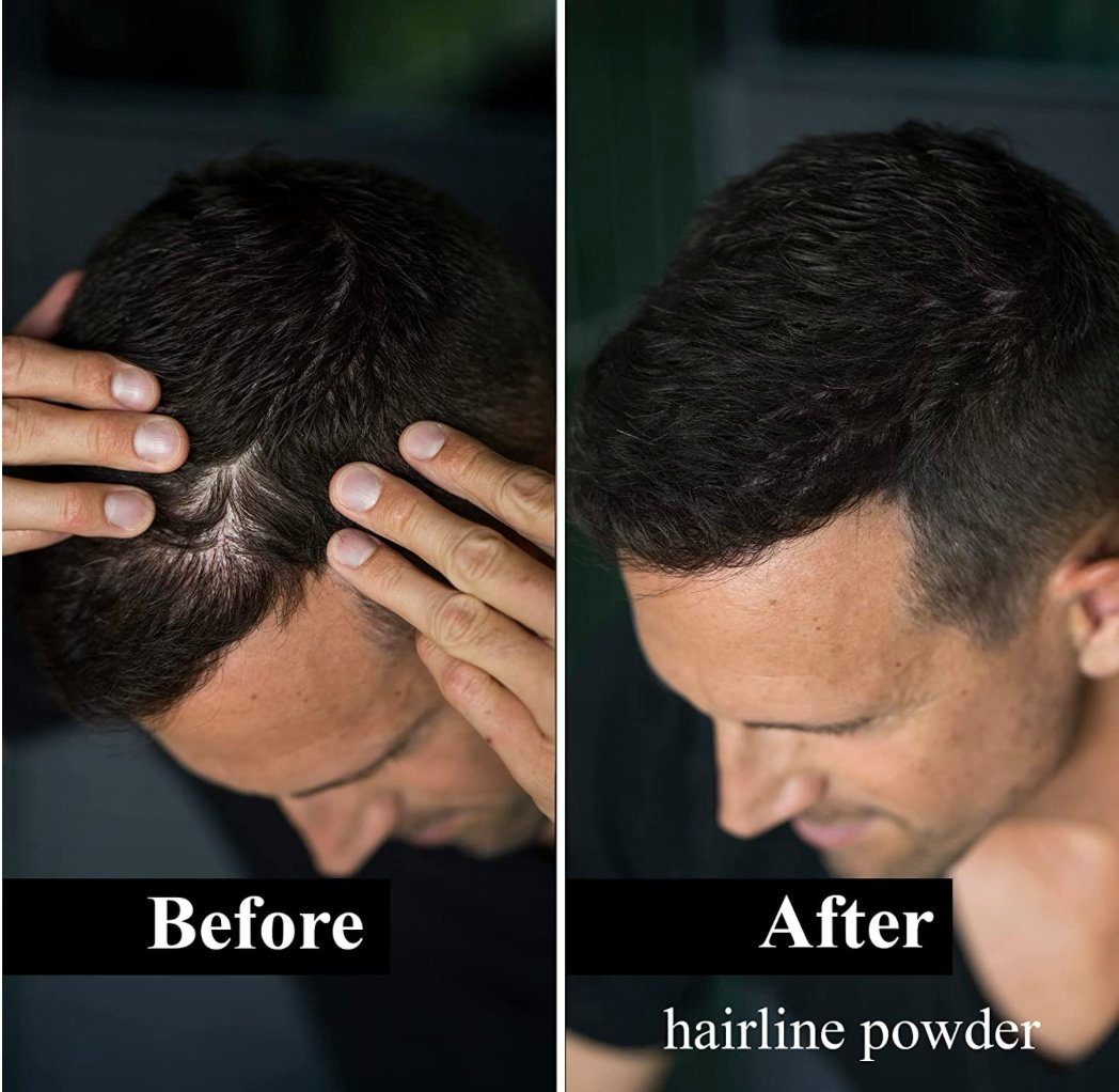 - Ansatz Leon - Miguel Hairline Concealer Haaransatz-Farbpuder kaschieren Powder Haar Rückstände 4g, zum Ohne Dunkelbraun