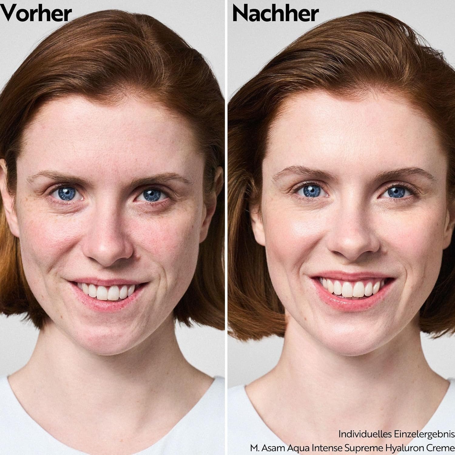 asambeauty Gesichtspflege Supreme Hyaluron Cream - Feuchtigkeitscreme, Gesichtscreme