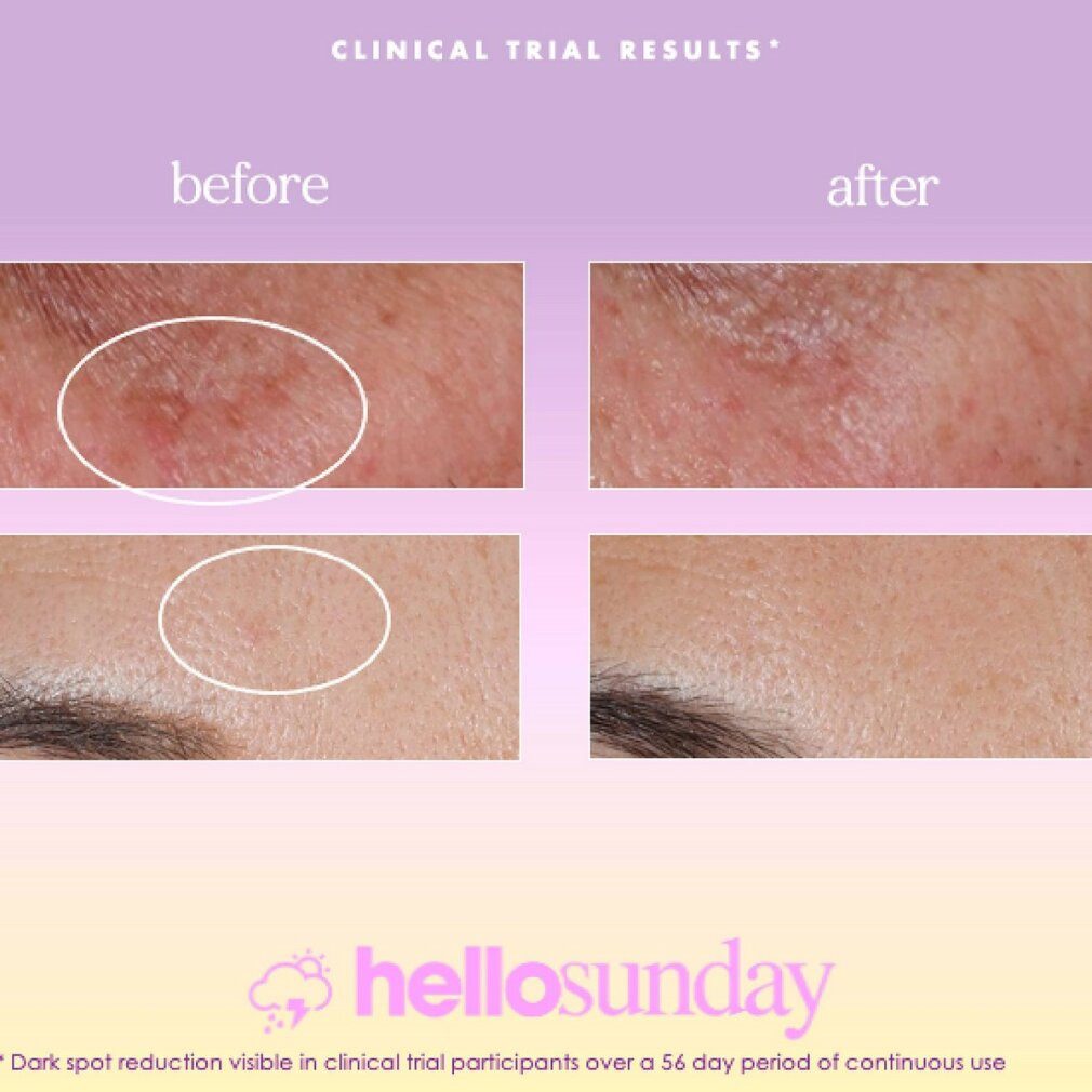 Hello Sunday Gesichtspflege the one that makes you glow Dark Spot Oil Serum SPF 40 - 30 ml