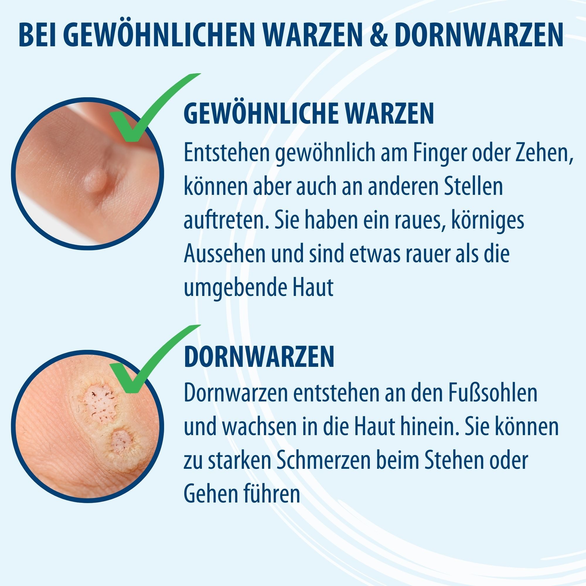 Evolsin Warzen-Behandlungsstift Evolsin – Anti Warzen Stift gegen Warzen
