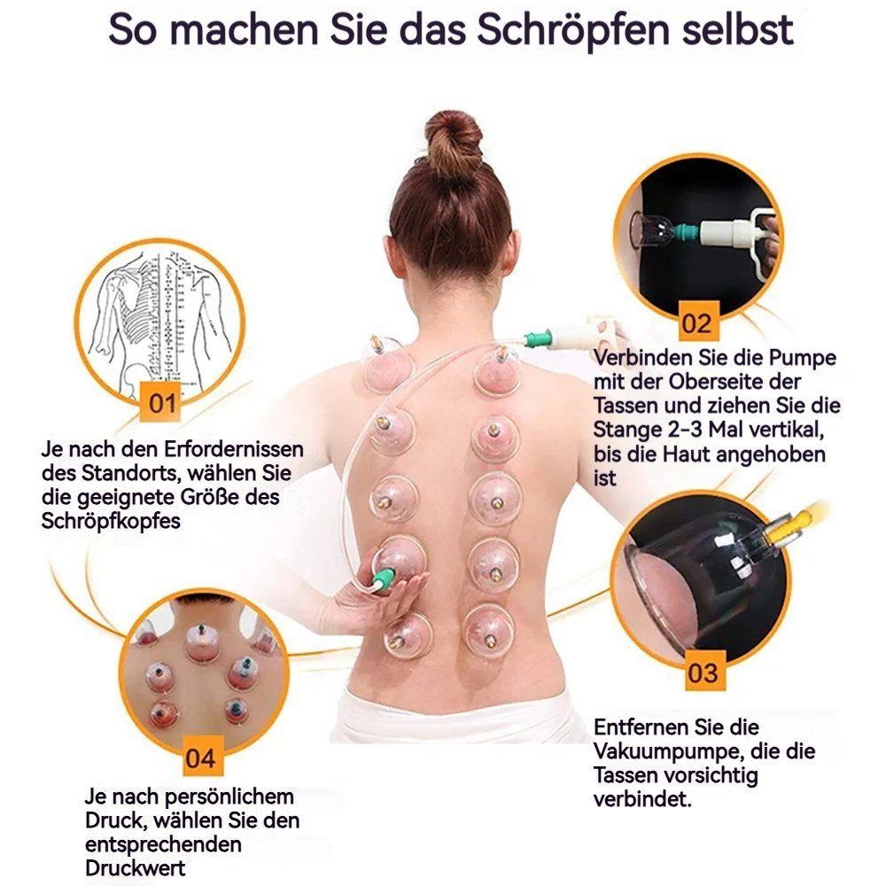 BlingBin Vakuum-Massager Vakuum Schröpfset mit 32 tlg Schröpfgläser Cupping Pumpe Schröpfset, 1er Set 32-tlg., 32tlg, Für Schmerzen Gelenke Faszien Cellulite Schröpfgläser Vakuumpumpe