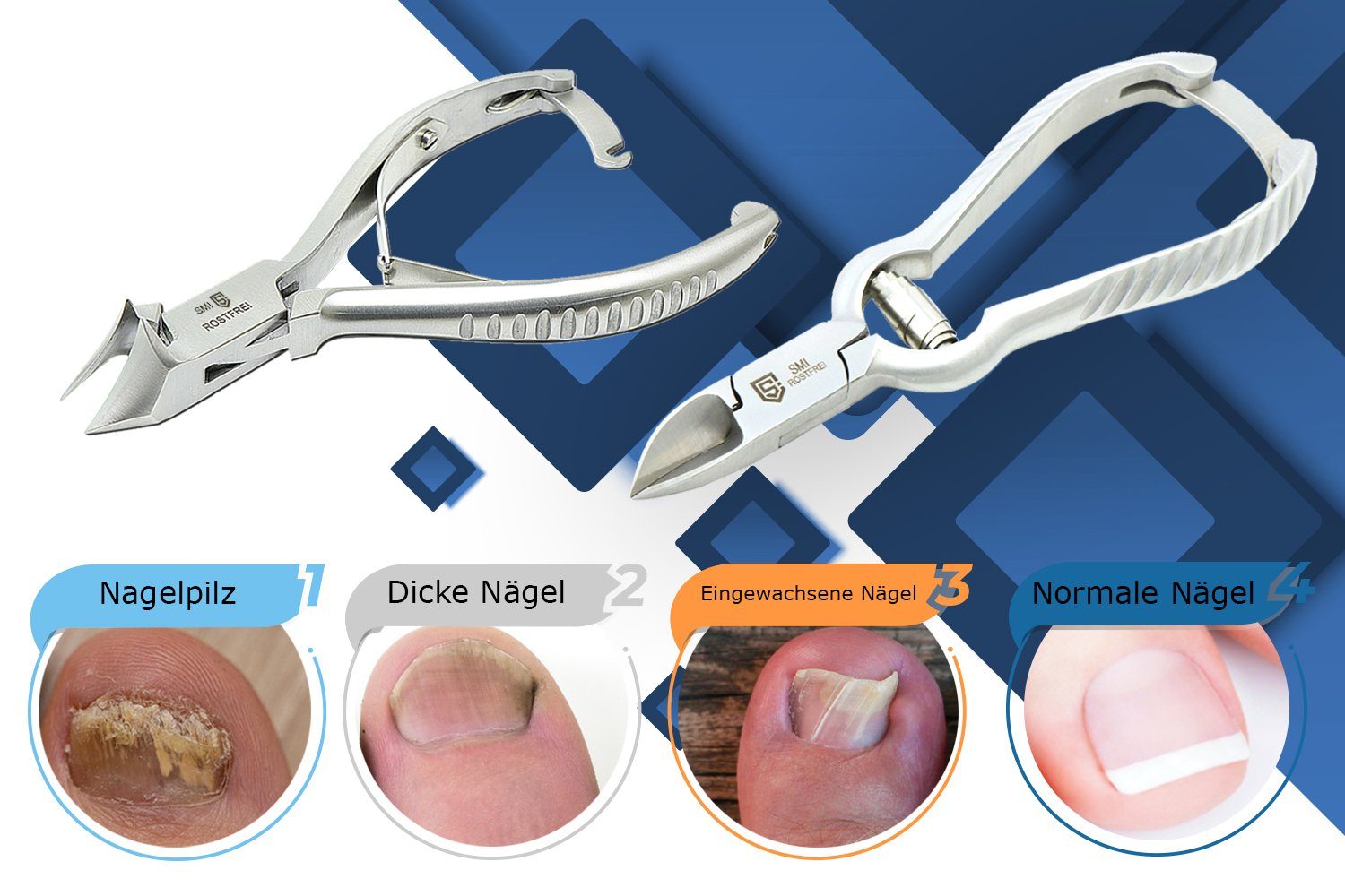 SMI Nagelzange 2tlg Fußnagelzange kopfschneider fussnagelzange kopfzange nagelzange, ergonomisch