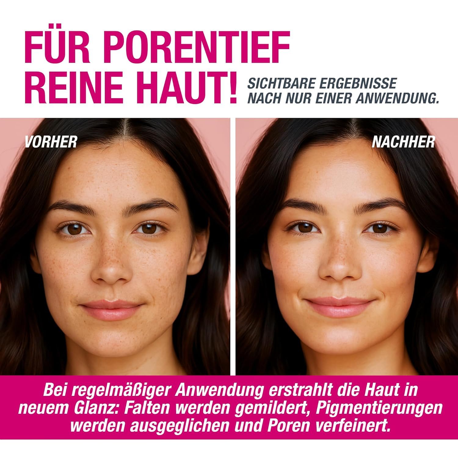 Svenja Walberg Gesichtspeeling VAMPIRE FACIAL PEEL® Fruchtsäurepeeling - 16% AHA + 5% TXA, mit Sofort-Effekt – Porenverfeinernd – Glow-Boost