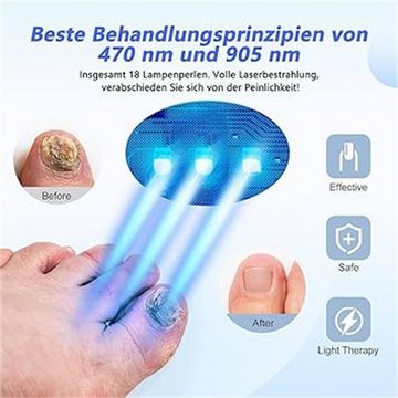 RefinedFlare Lichthärtungsgerät Hocheffizientes Onychomykose-Kaltlaser-Behandlungsgerät Maniküre-Lampe