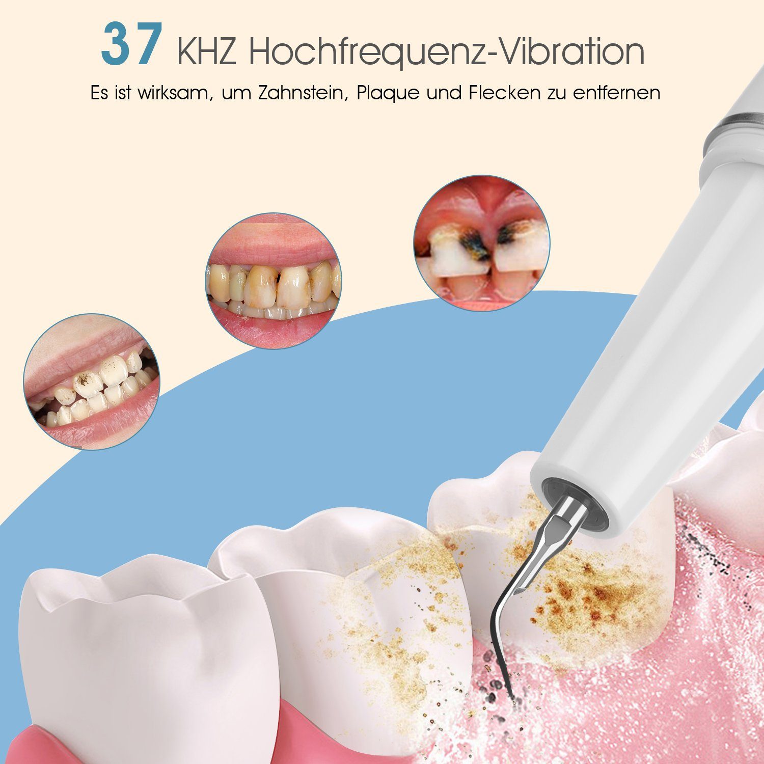 oyajia Zahnpflege-Set Zahnreinigung Set, Ultraschall Zahnsteinentferner mit 5 Reinigungsmodi, 5 Renigungsmodi, mit 3 zusätzlichen Aufsätzen für Menschen und Hunde