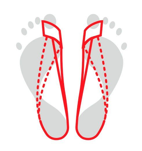 Fußgut Hallux-Bandage Korrektur-Schlaufe, in allen Schuhen tragbar, flache Verarbeitung, Zugschlaufe ergonomisch geformt, Zugband elastisch, flexibel