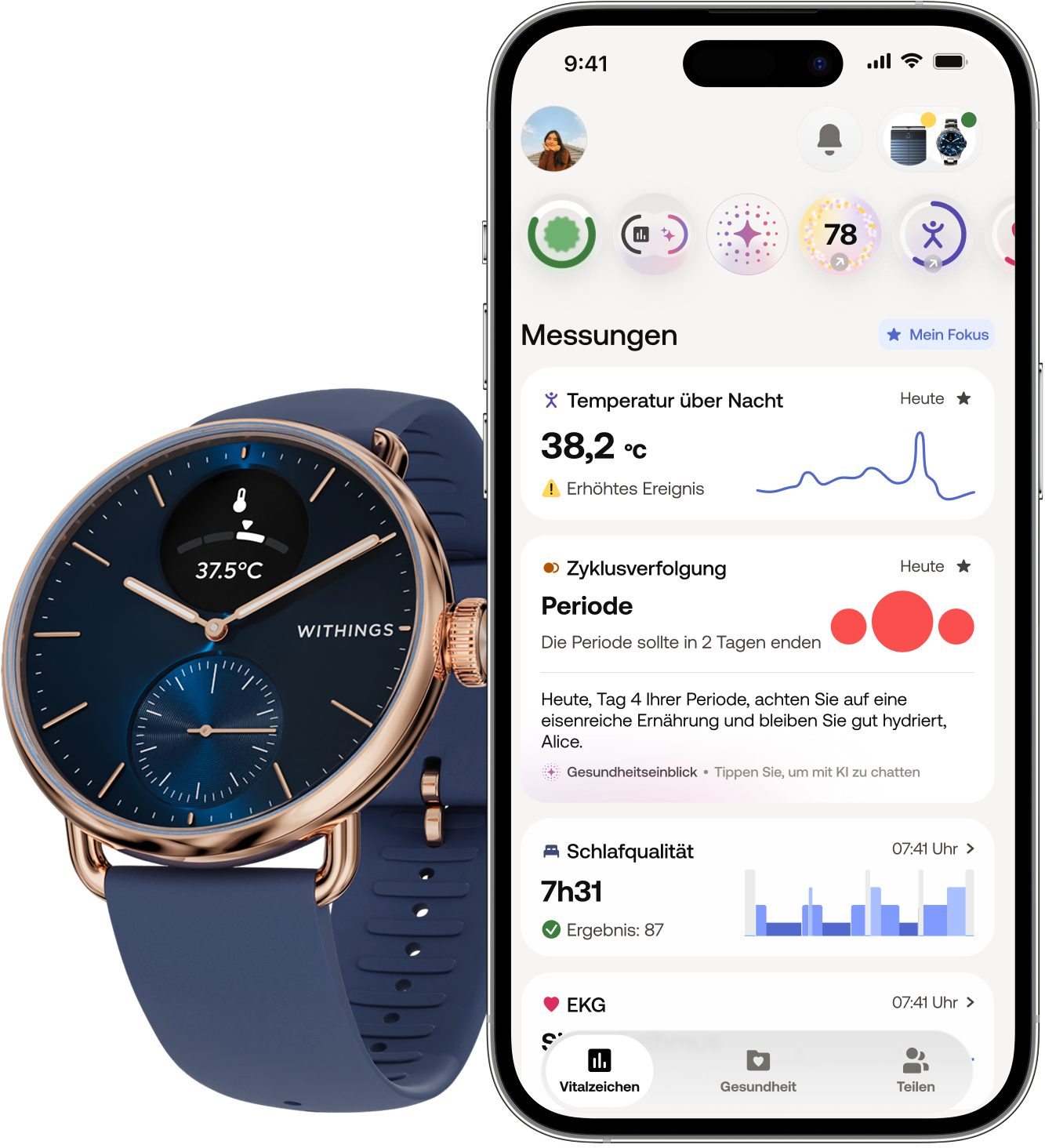 Withings ScanWatch 2 38mm, hybrid, Akku bis 35 Tage, 50 M Wasserdicht Smartwatch (HealthSense OS), Aktivitätstracking, Schlafüberwachung, Herzgesundheit, Temperatur uvm.